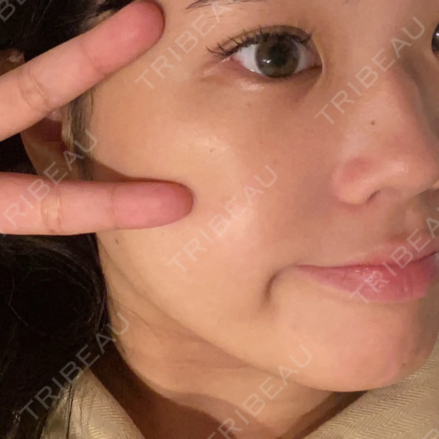 施術前の写真