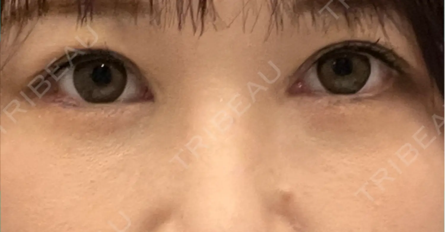 施術前の写真