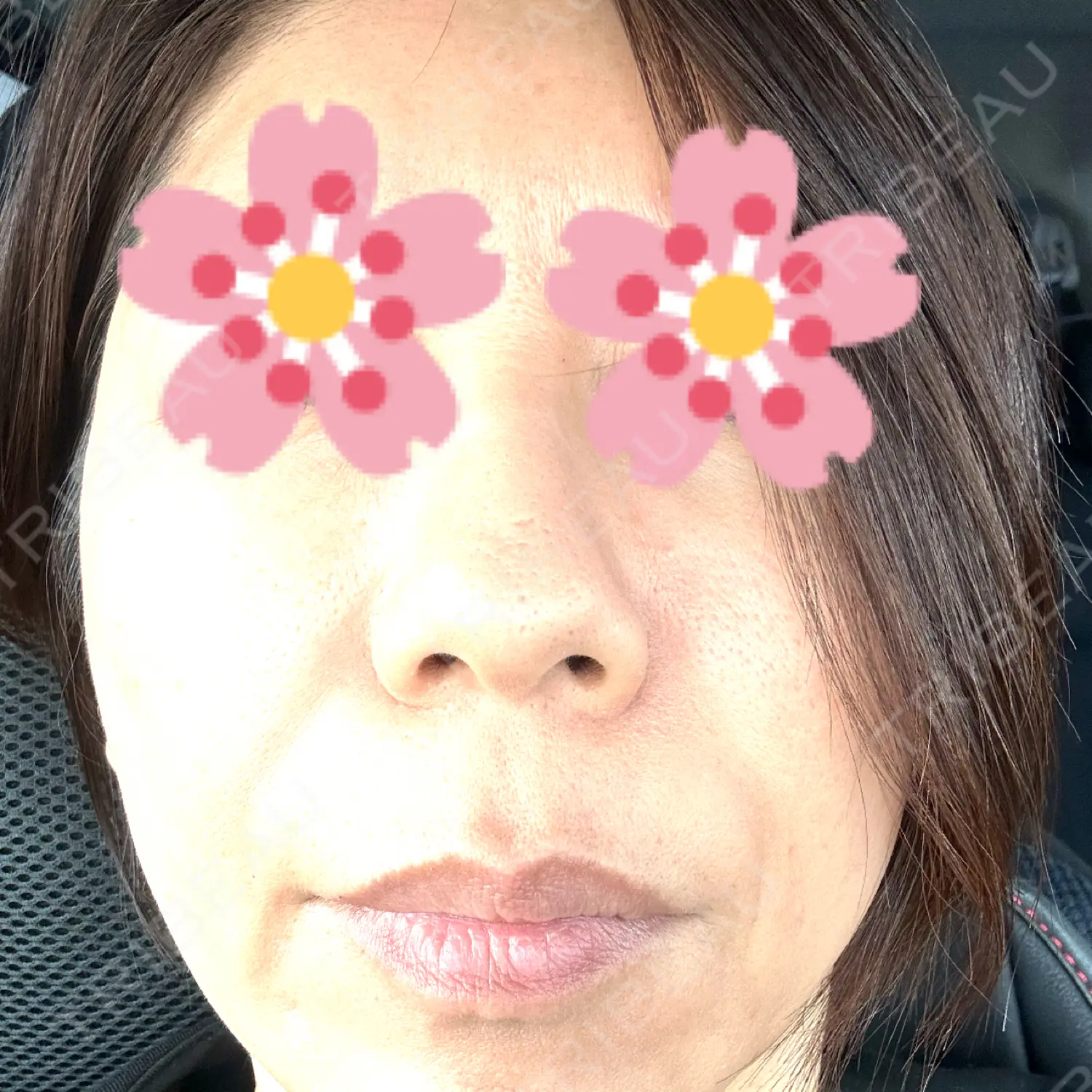 施術前の写真