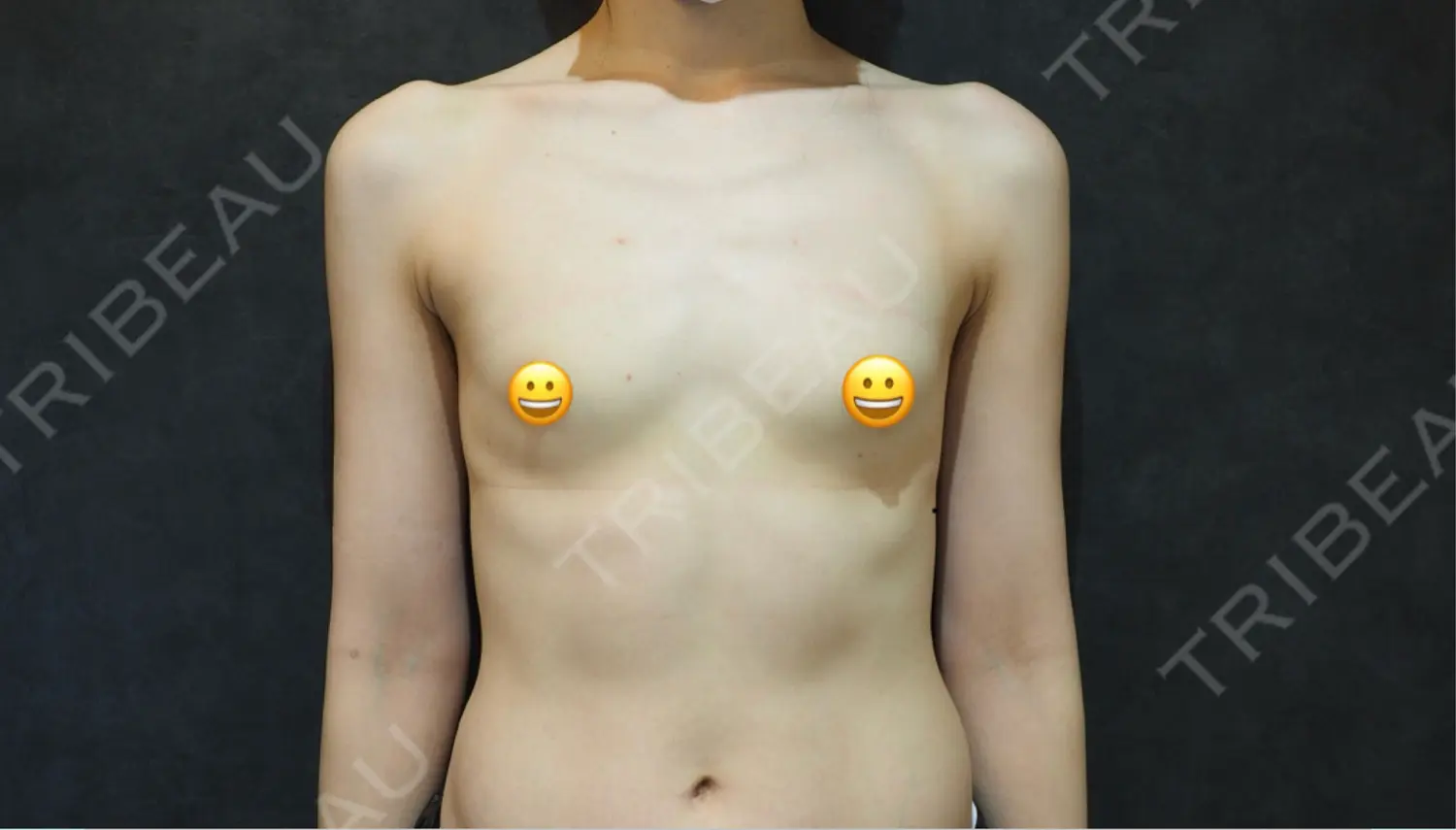 施術前の写真