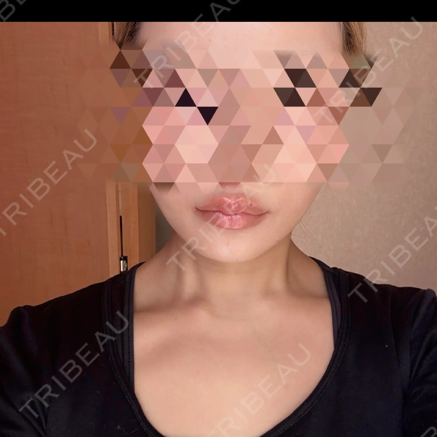 施術前の写真