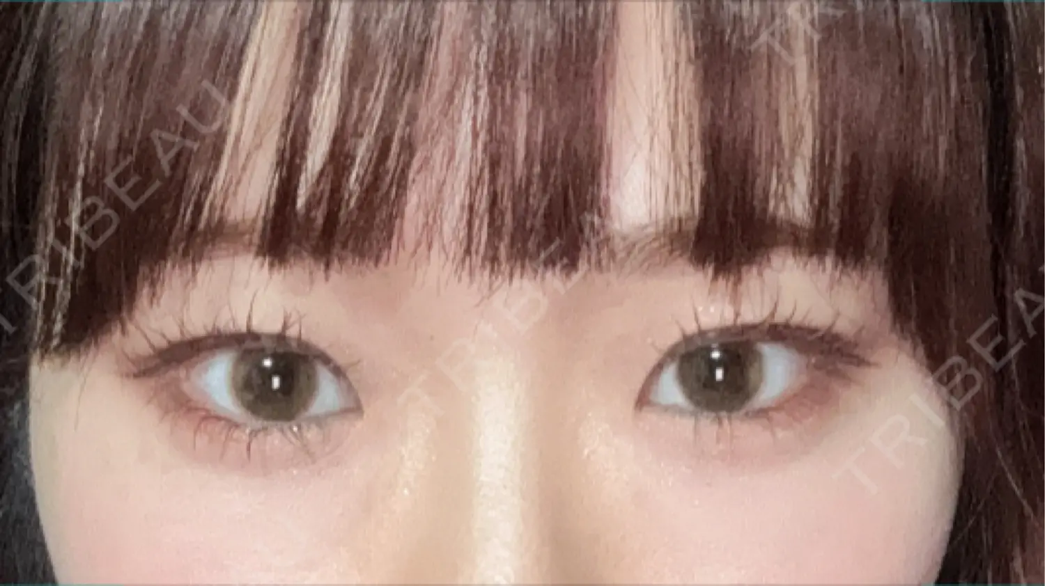施術前の写真