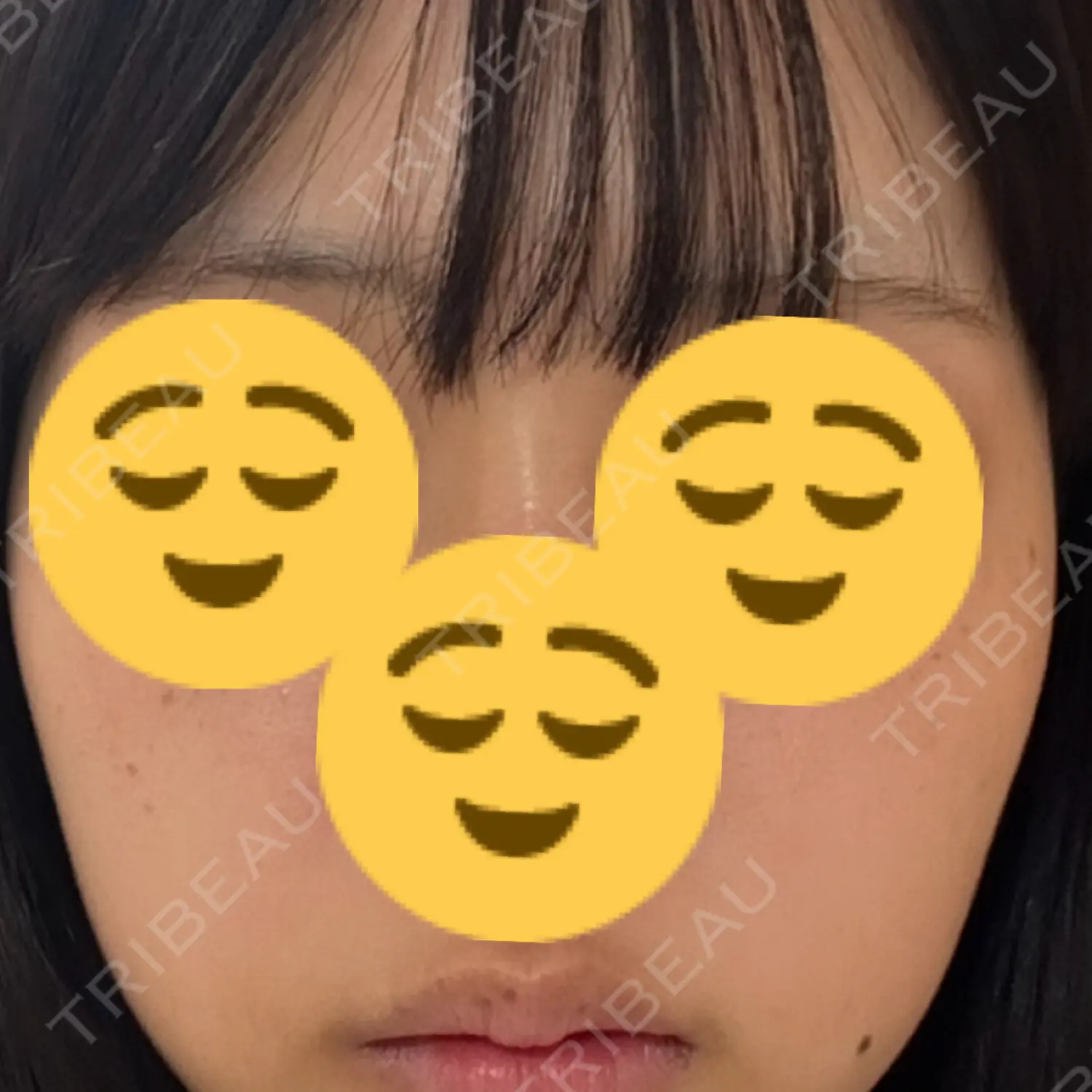 施術前の写真