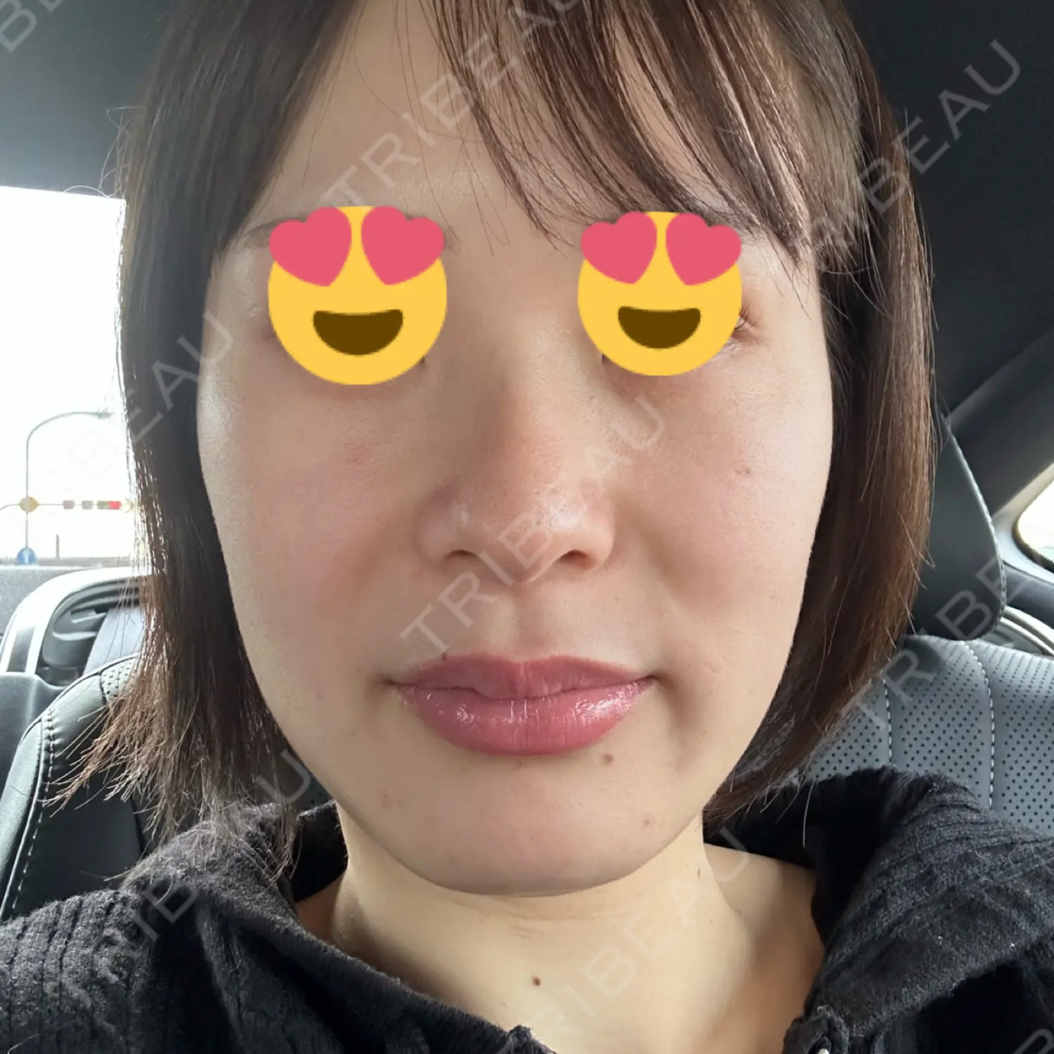 施術前の写真