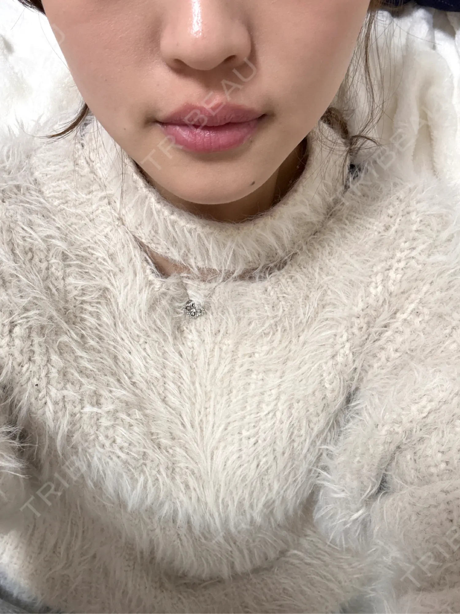 施術前の写真