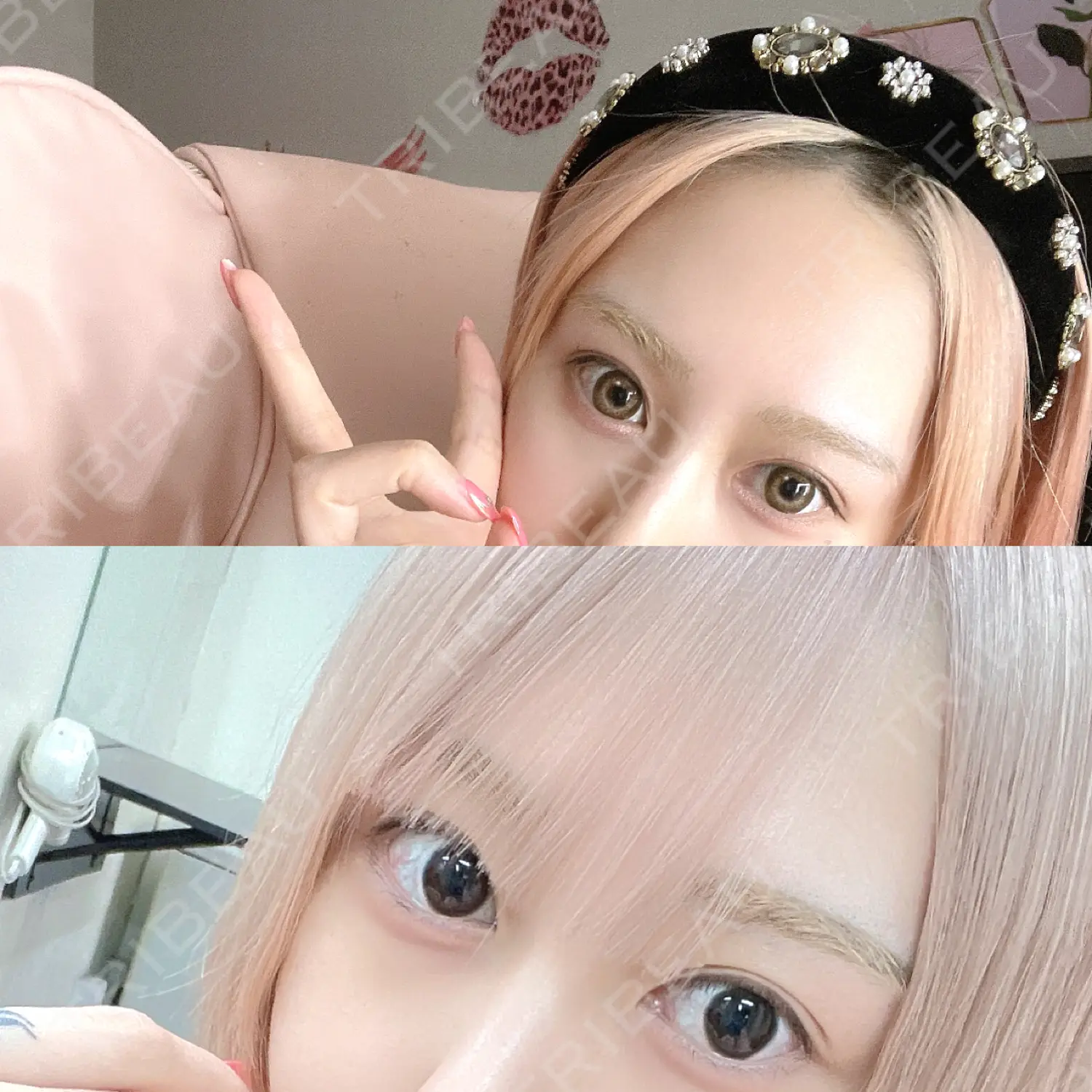 施術前の写真