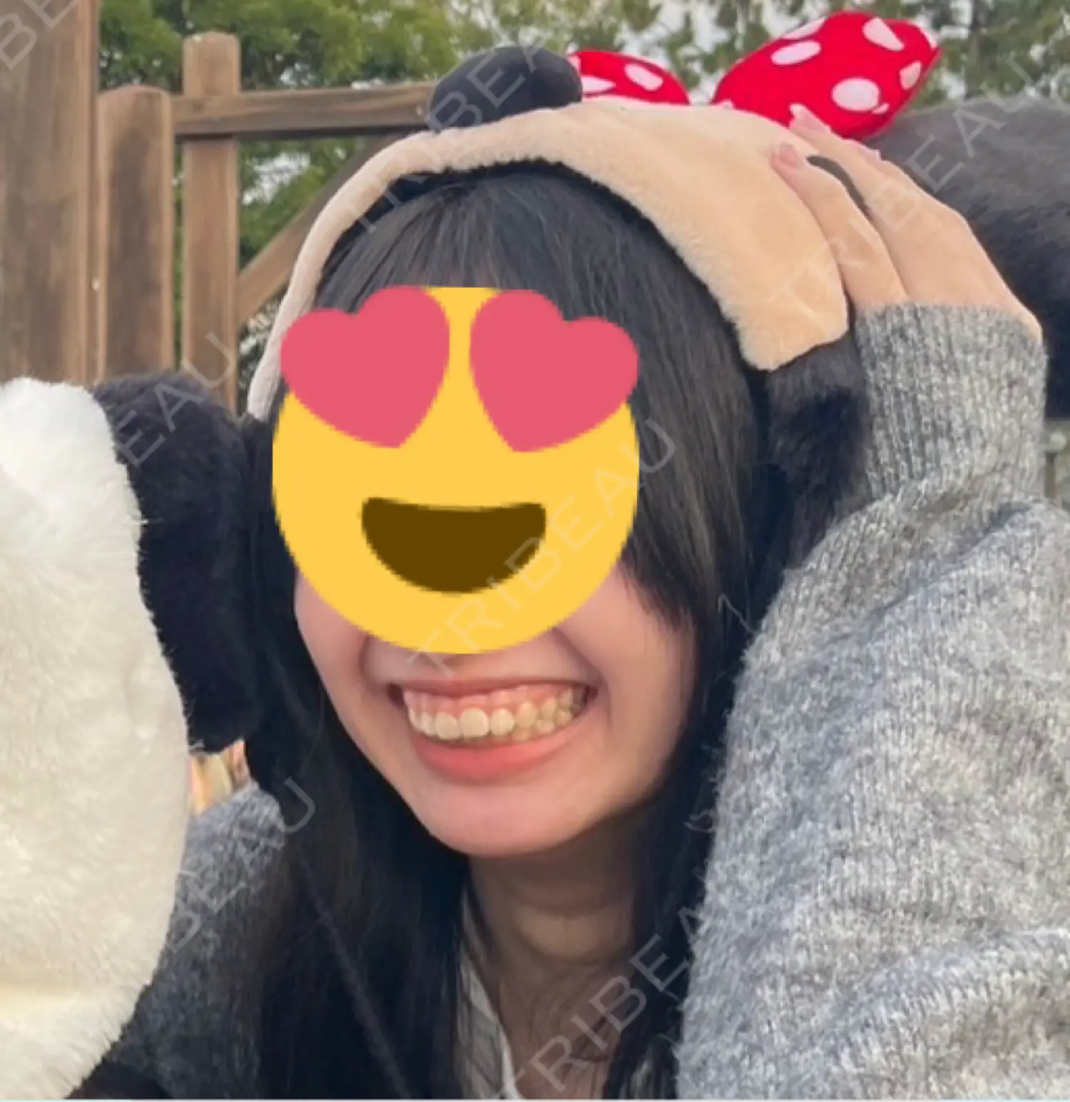 施術前の写真