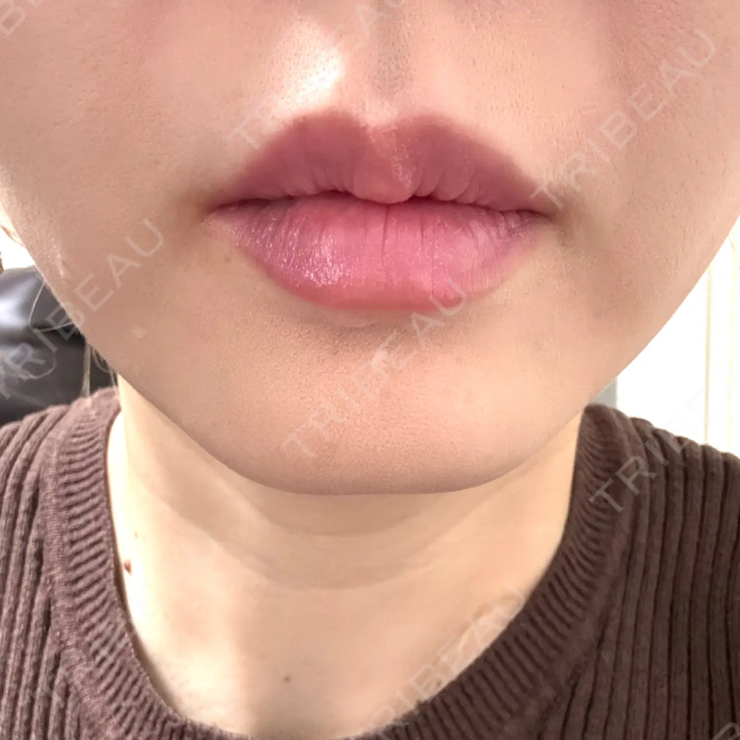施術前の写真
