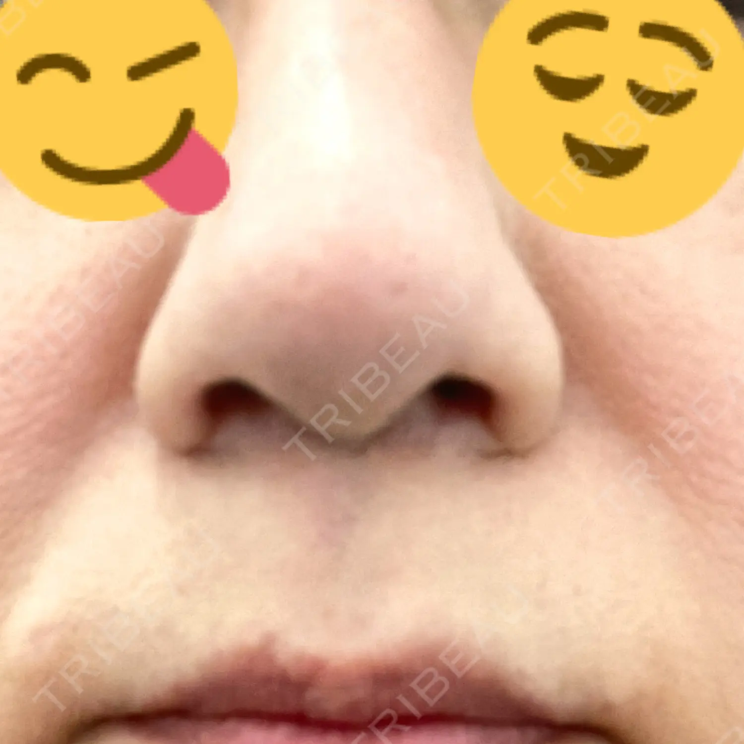 施術前の写真