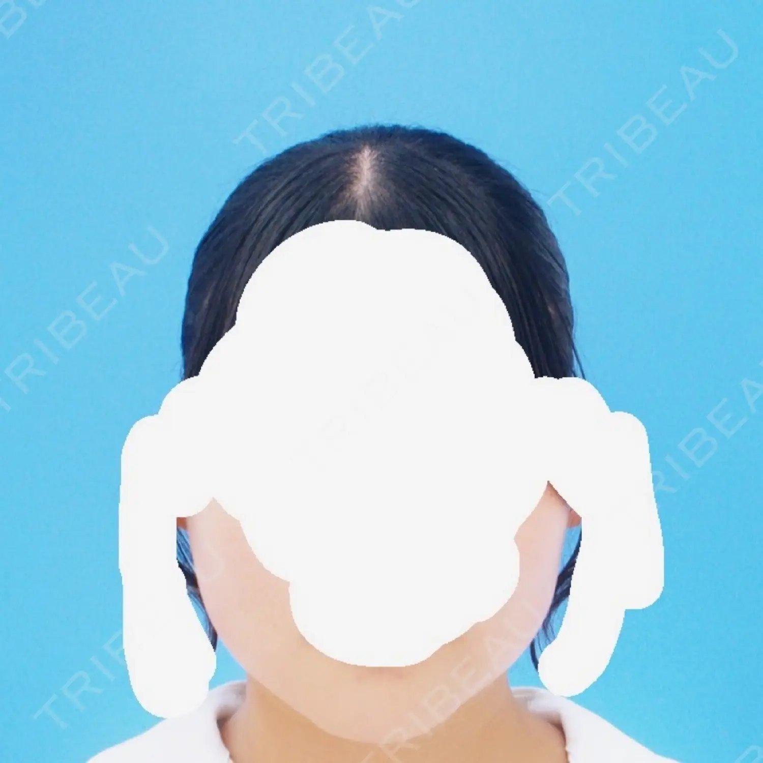施術前の写真