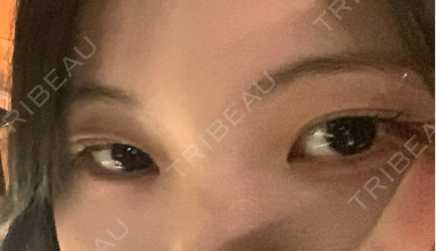 施術前の写真