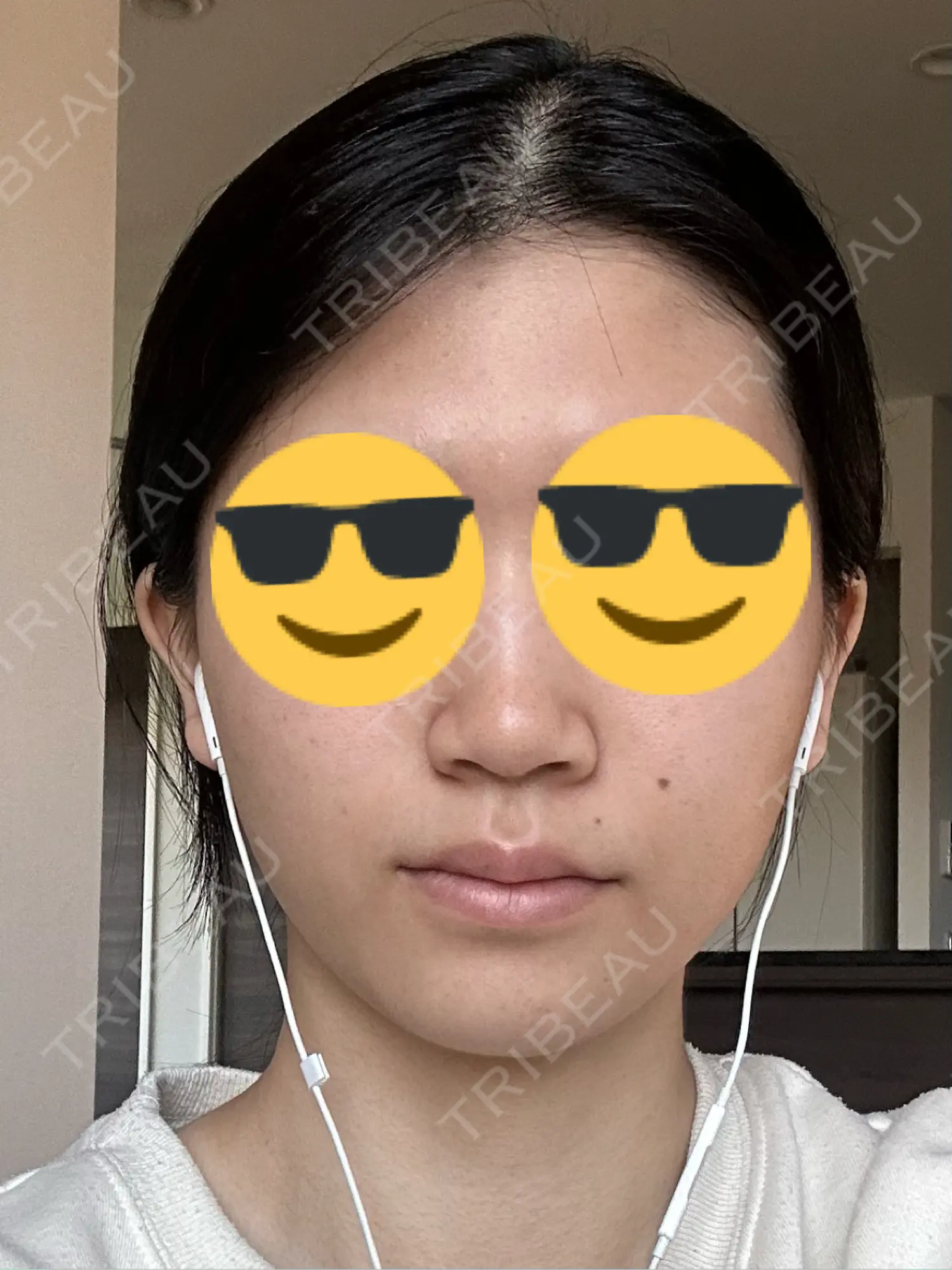 施術前の写真