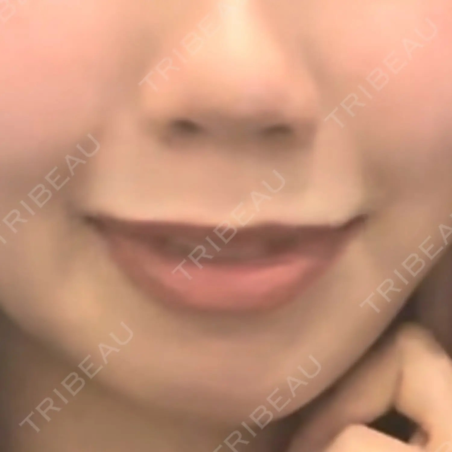 施術前の写真