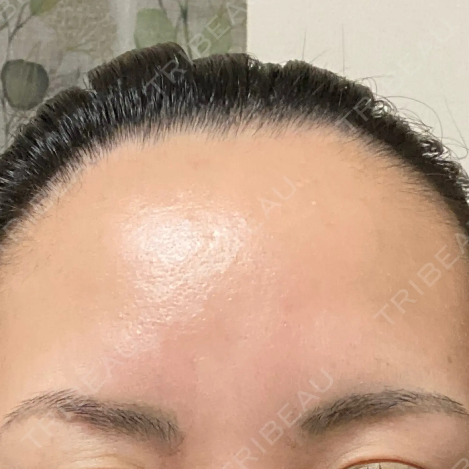 施術前の写真