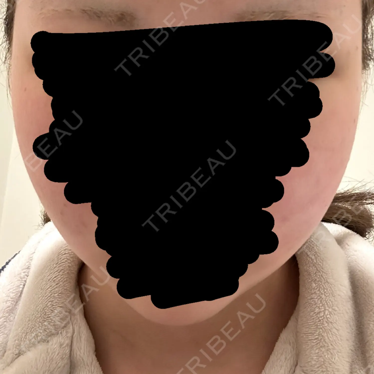 施術前の写真