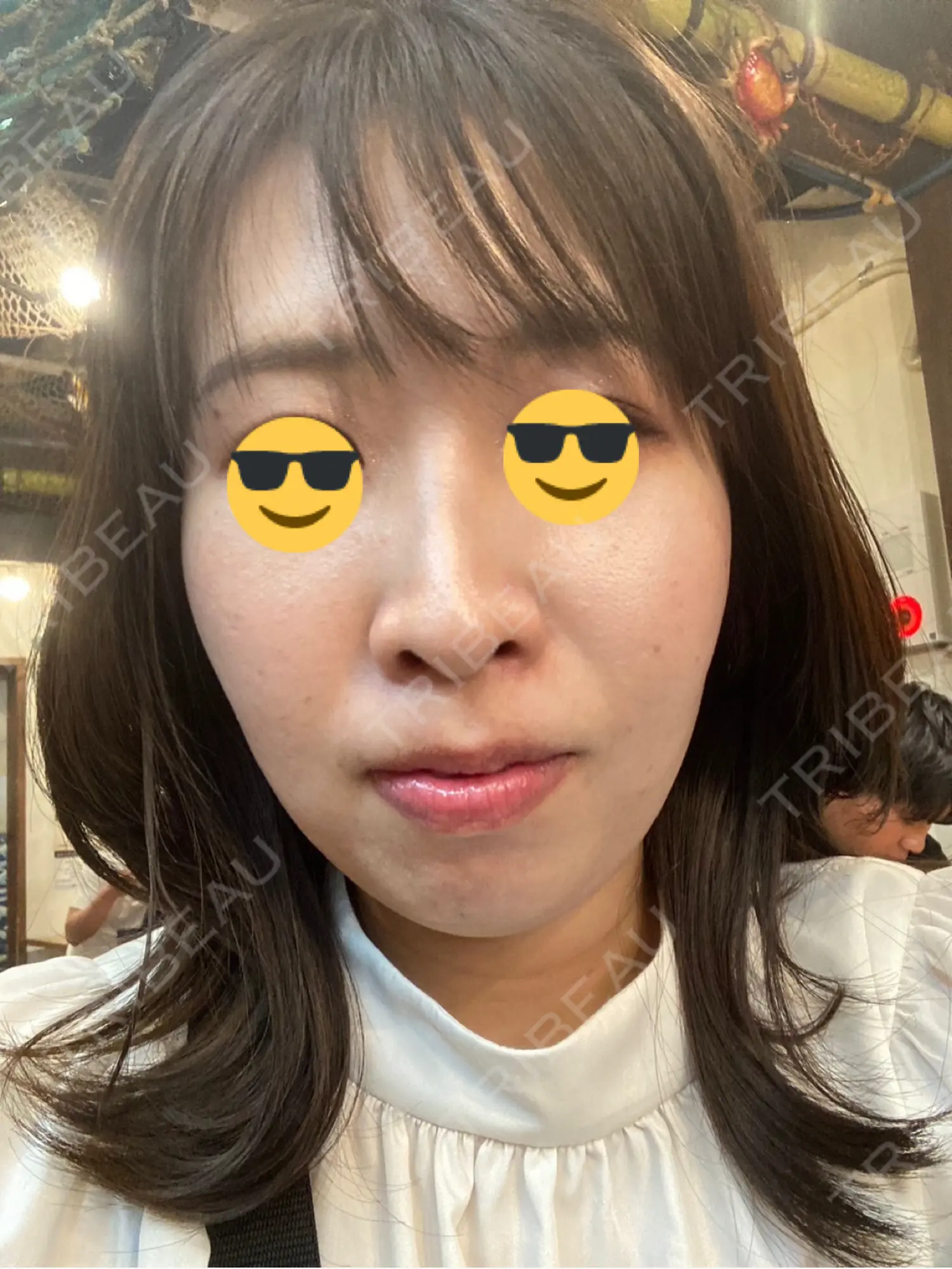 施術前の写真