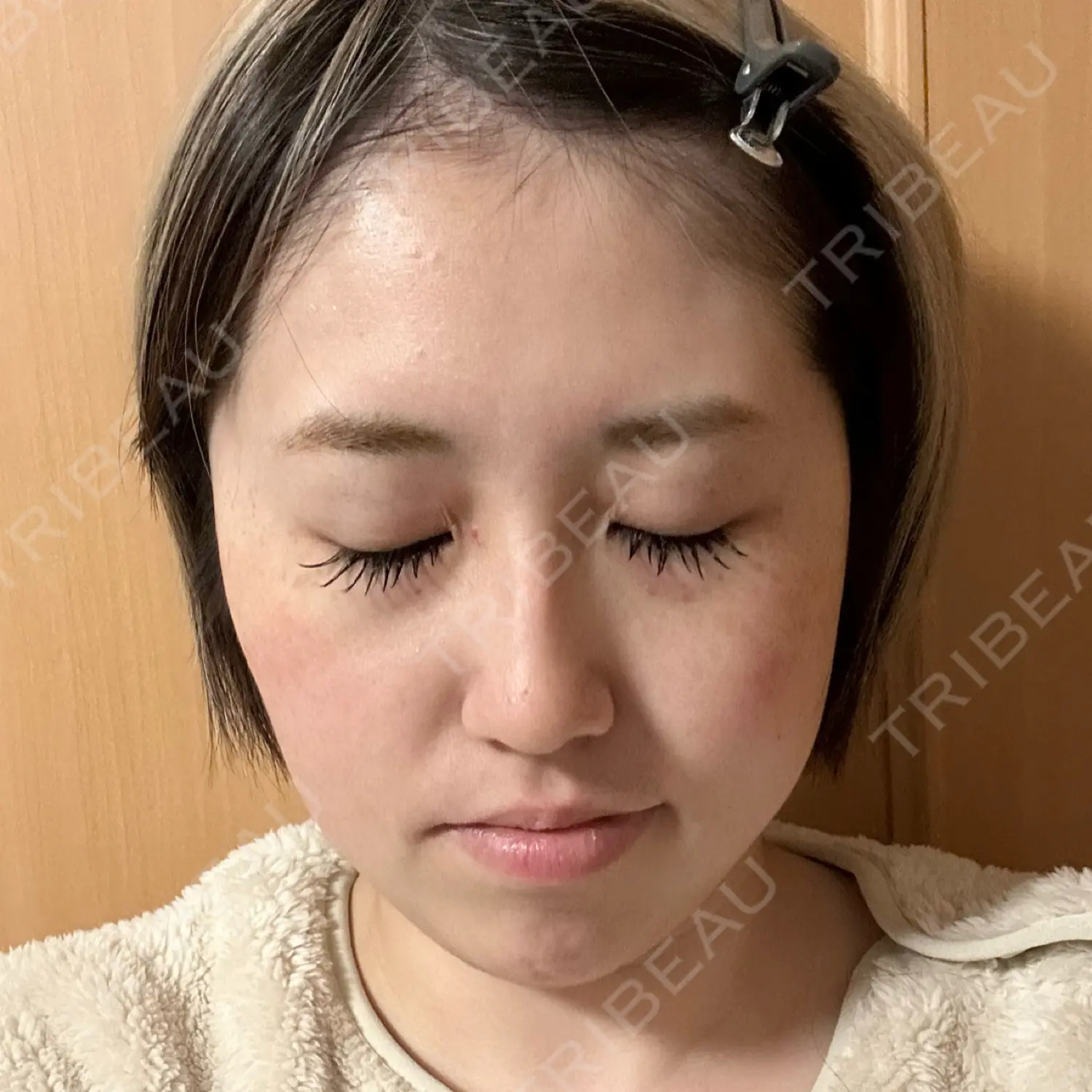 施術前の写真