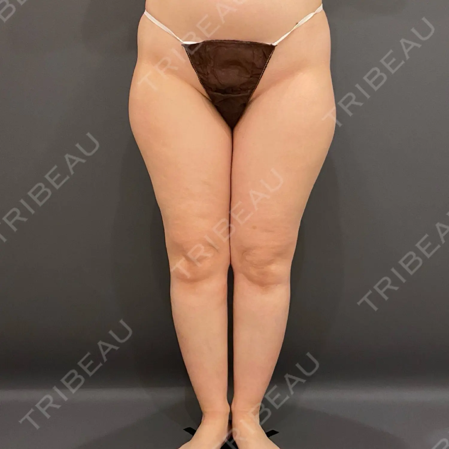 施術前の写真