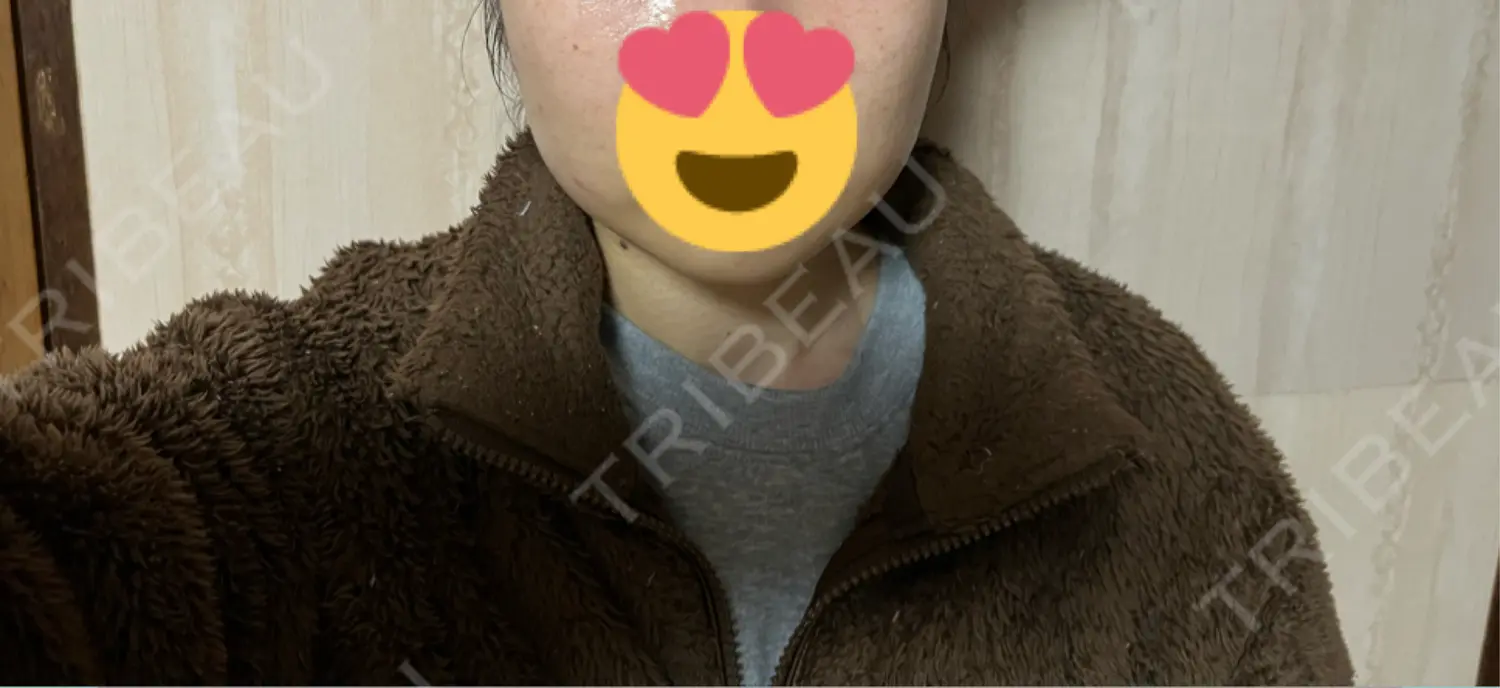 施術前の写真