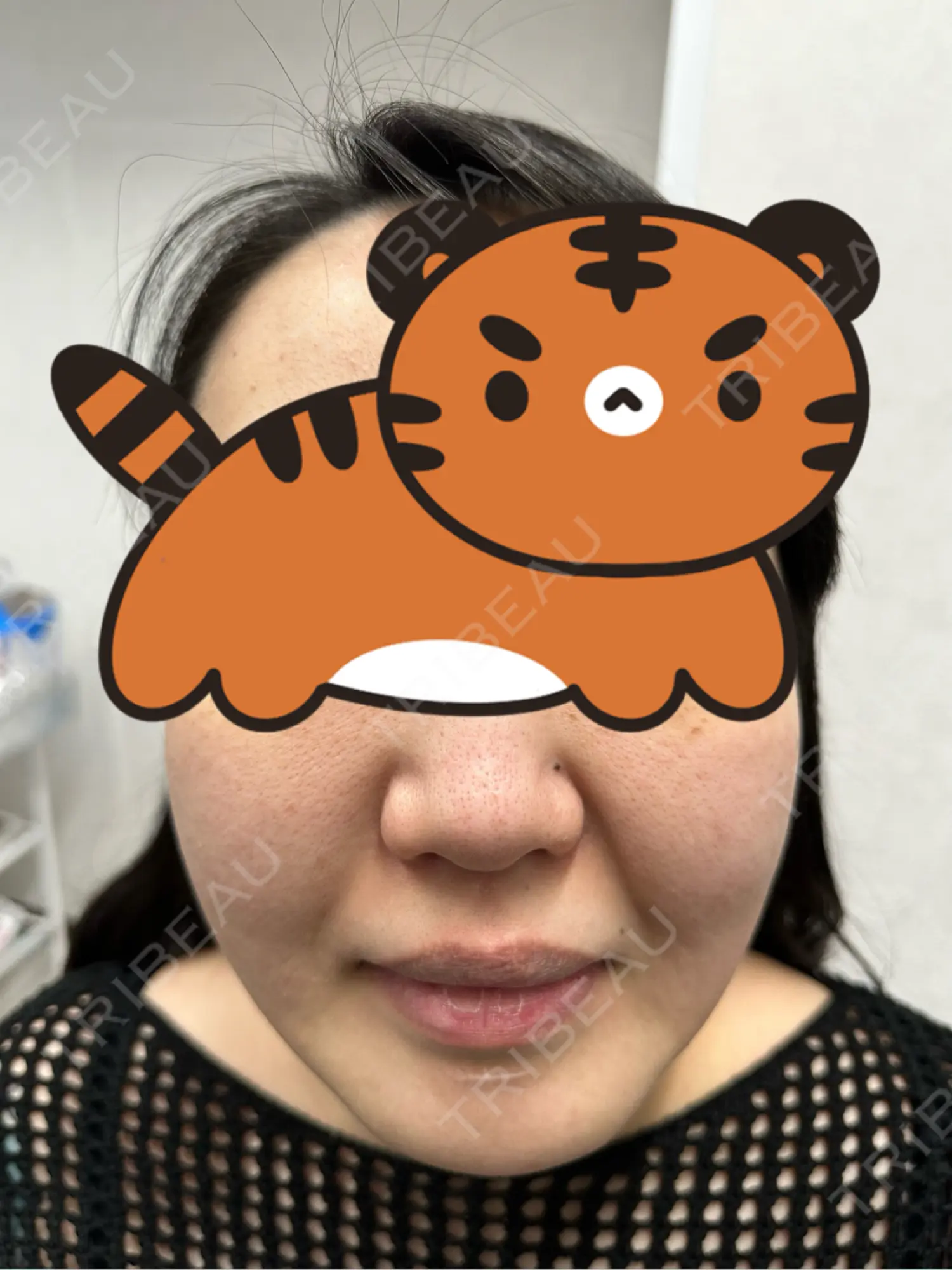 施術前の写真