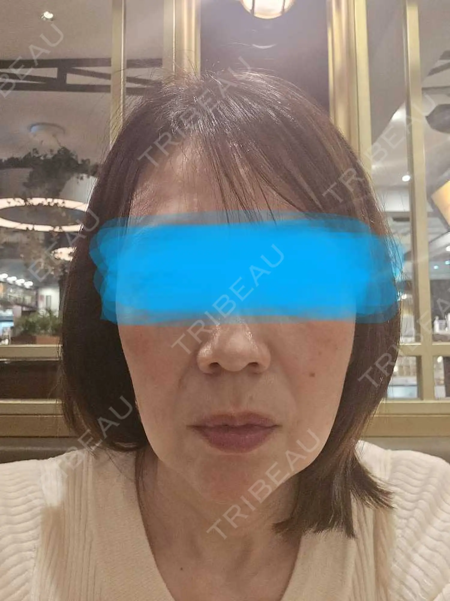 施術前の写真