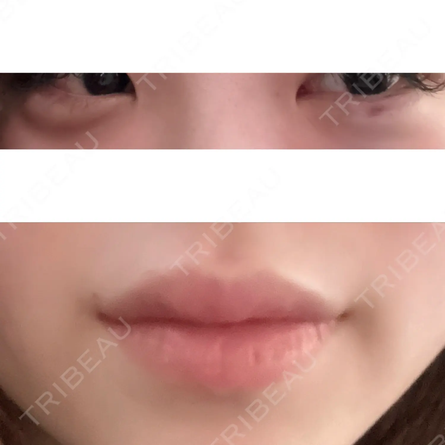 施術前の写真