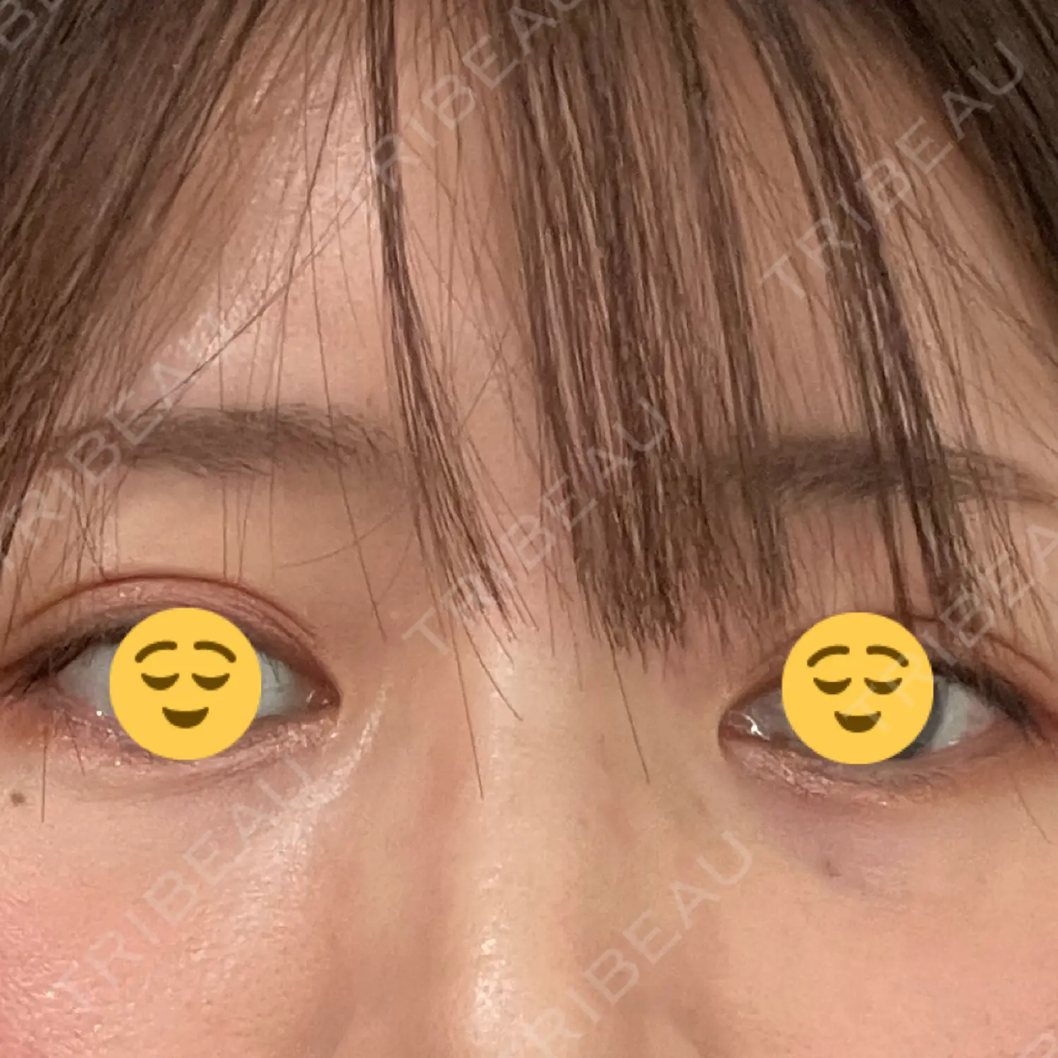 施術前の写真