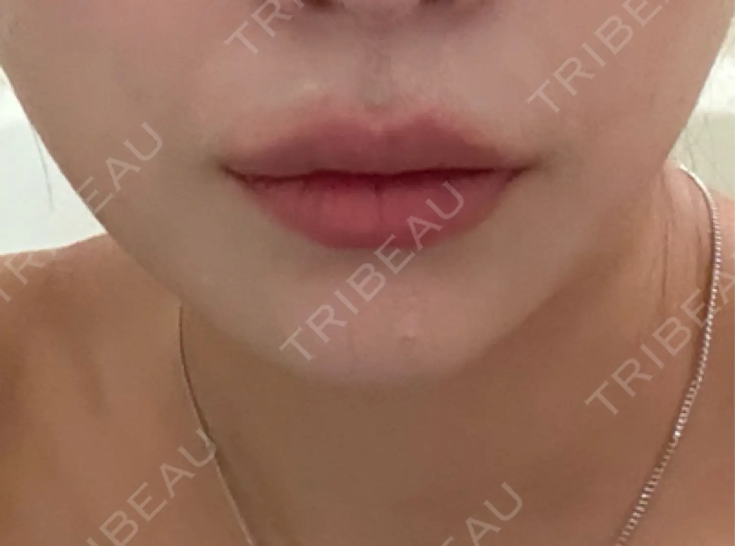 施術前の写真