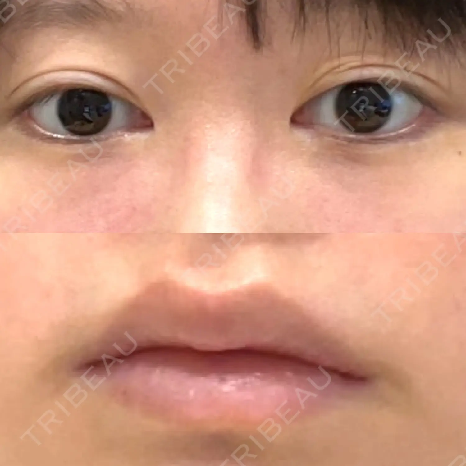施術前の写真