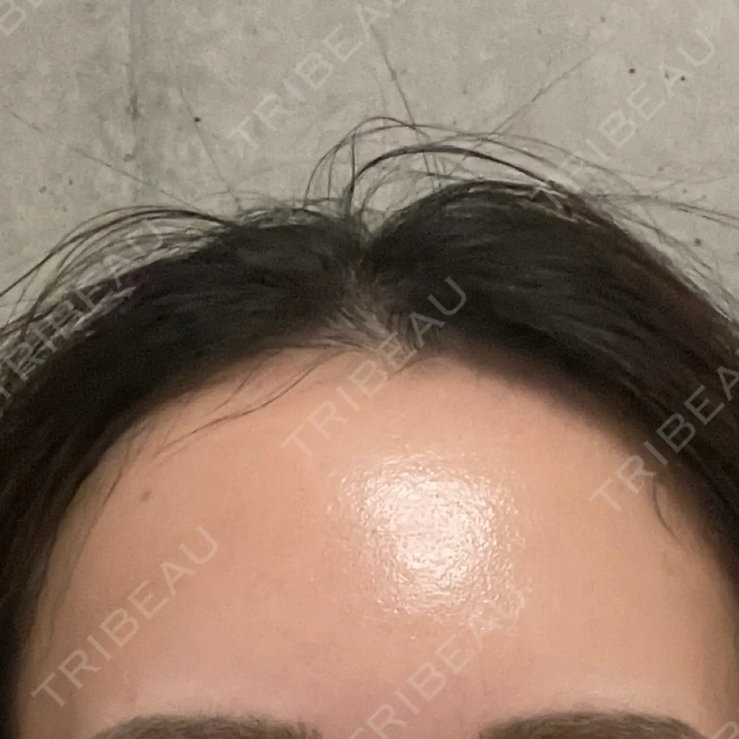 施術前の写真