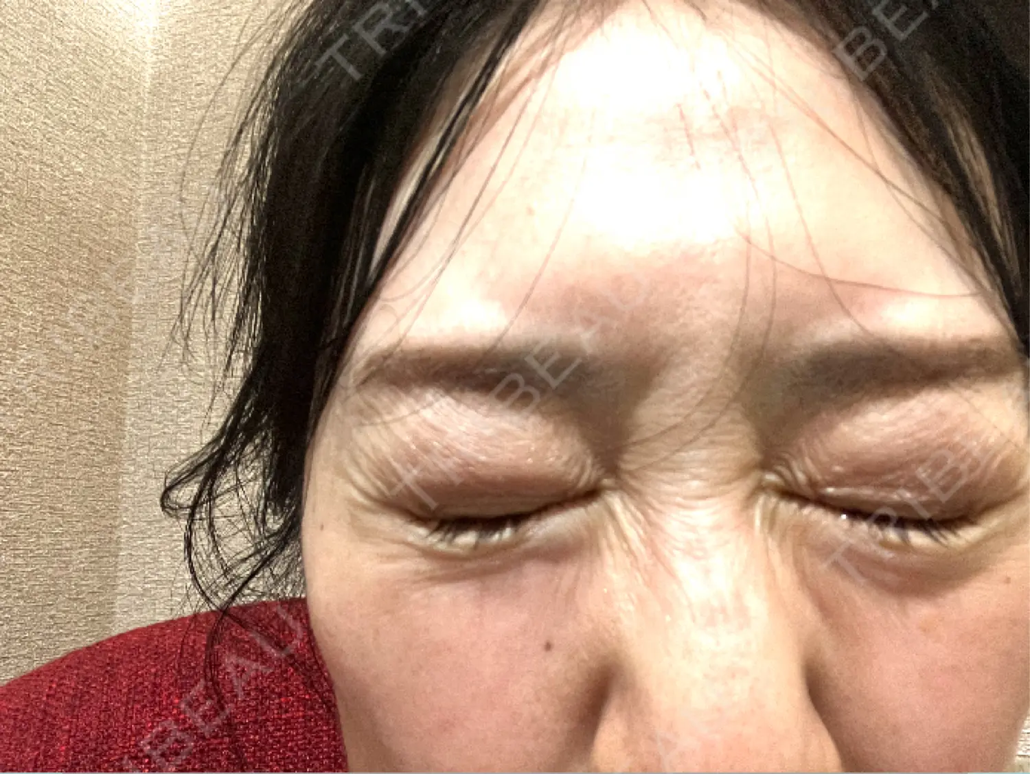 施術前の写真