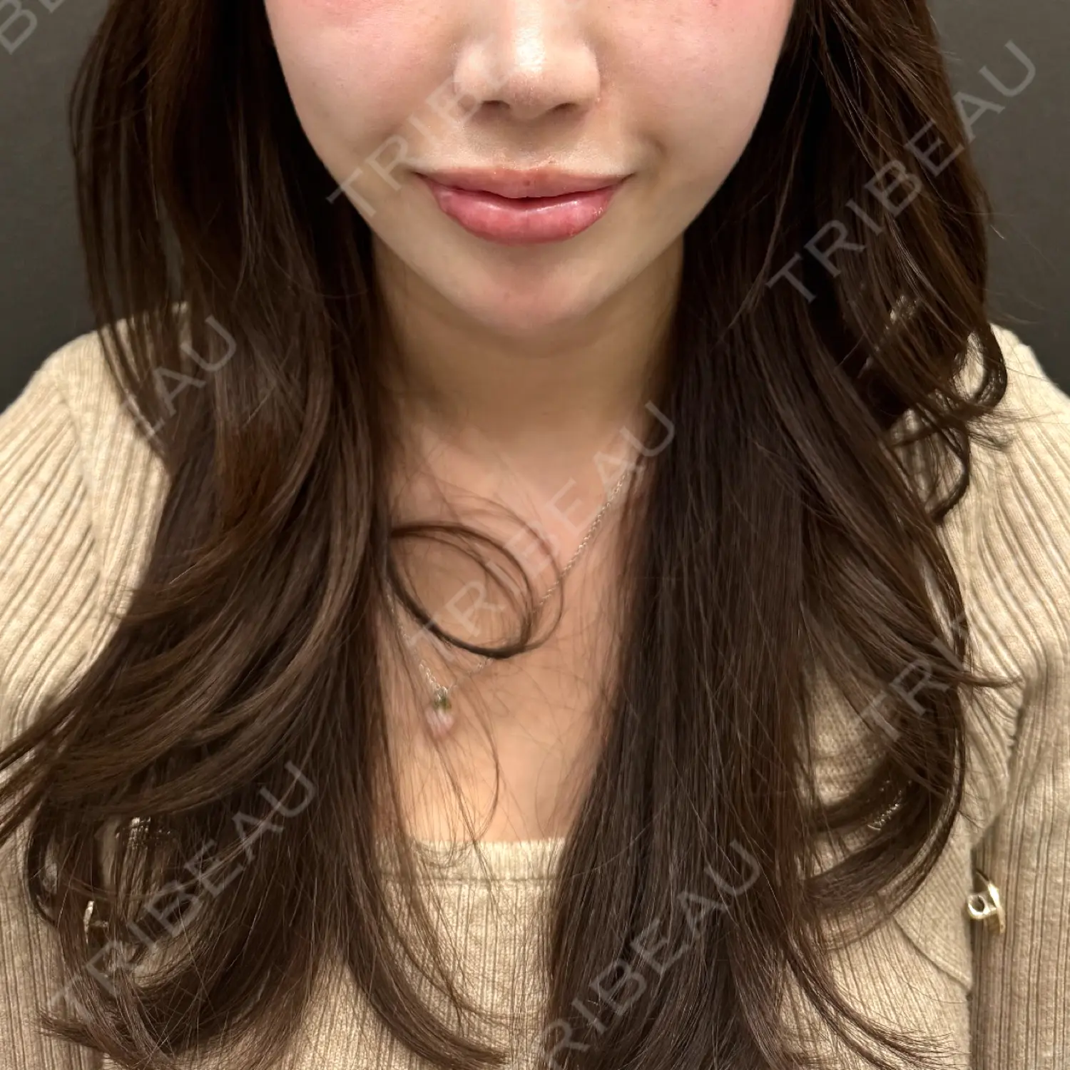 施術前の写真