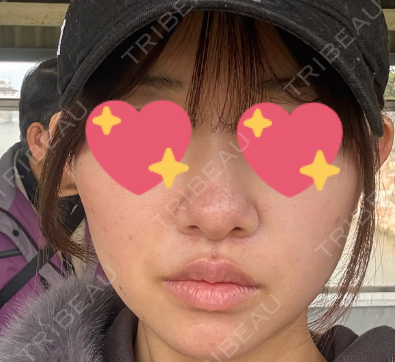 施術前の写真