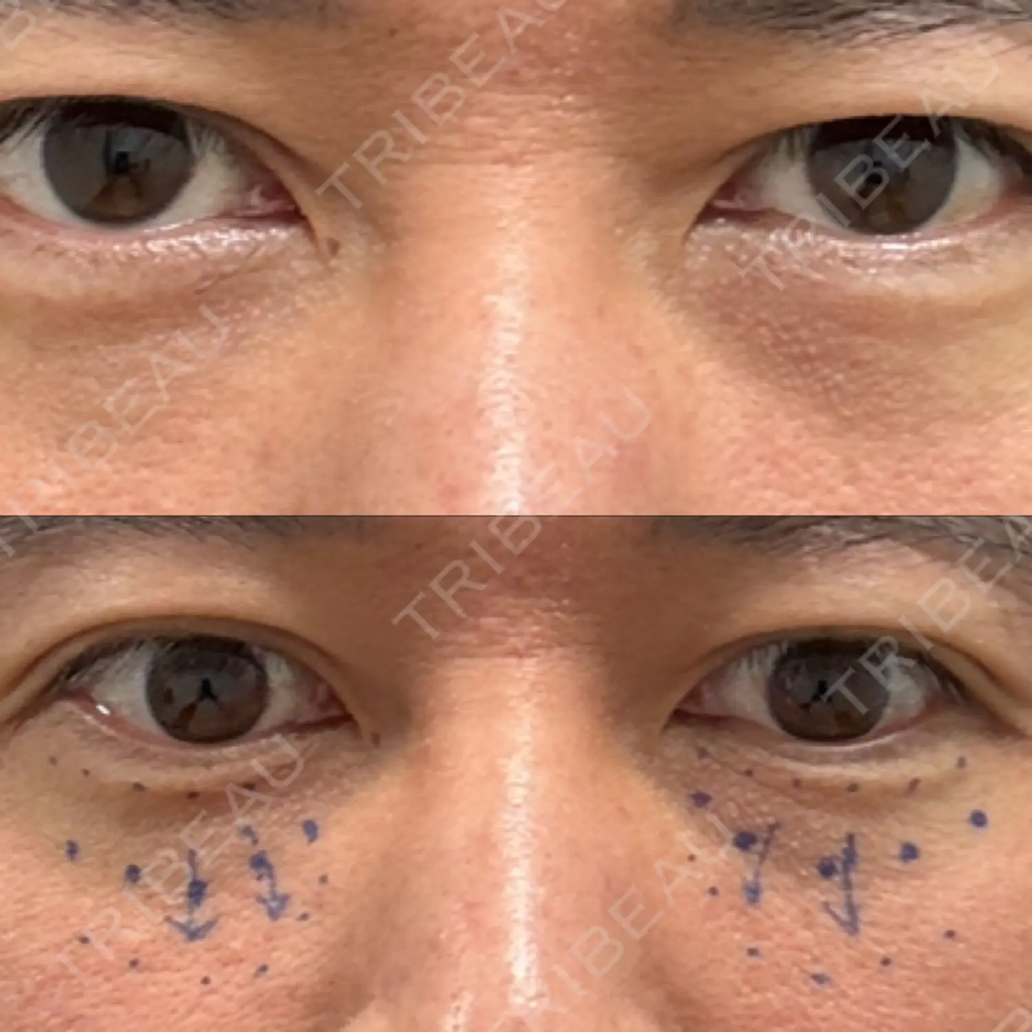 施術前の写真