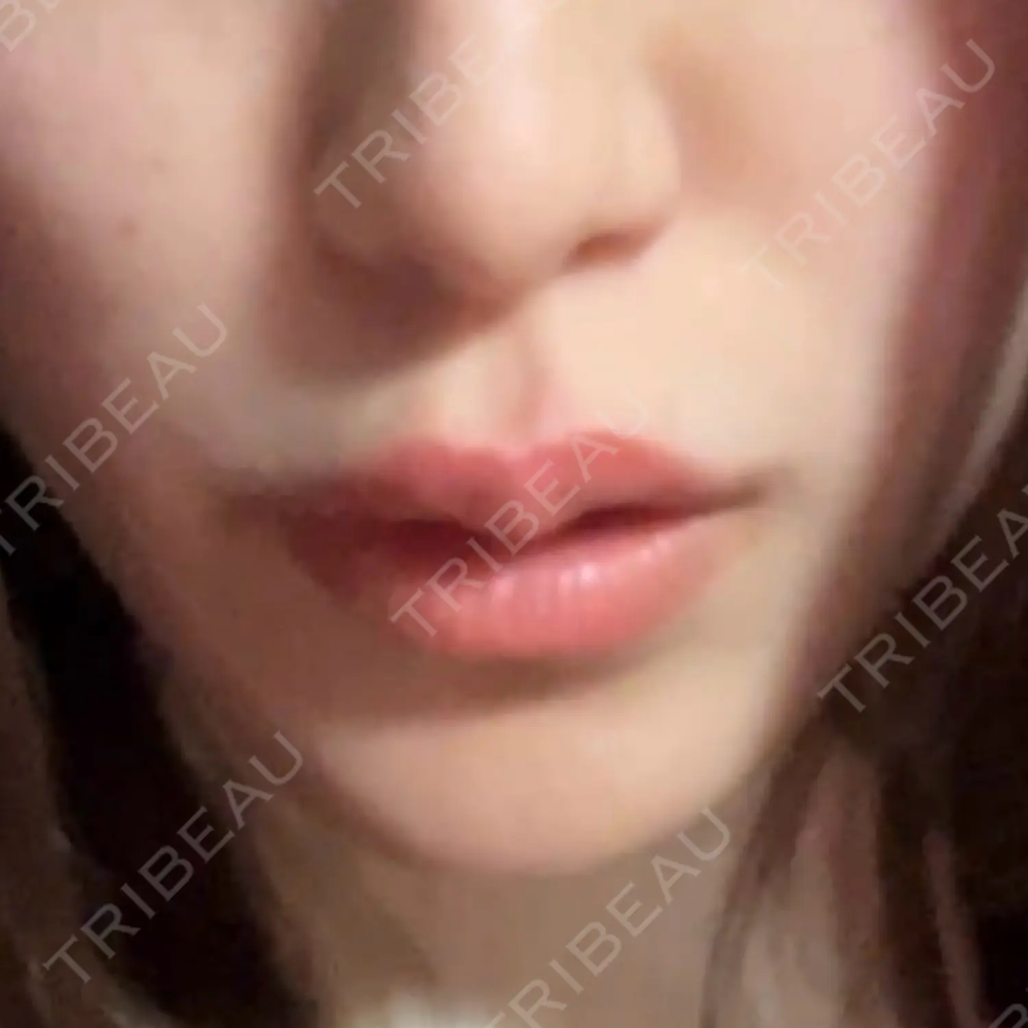 施術前の写真