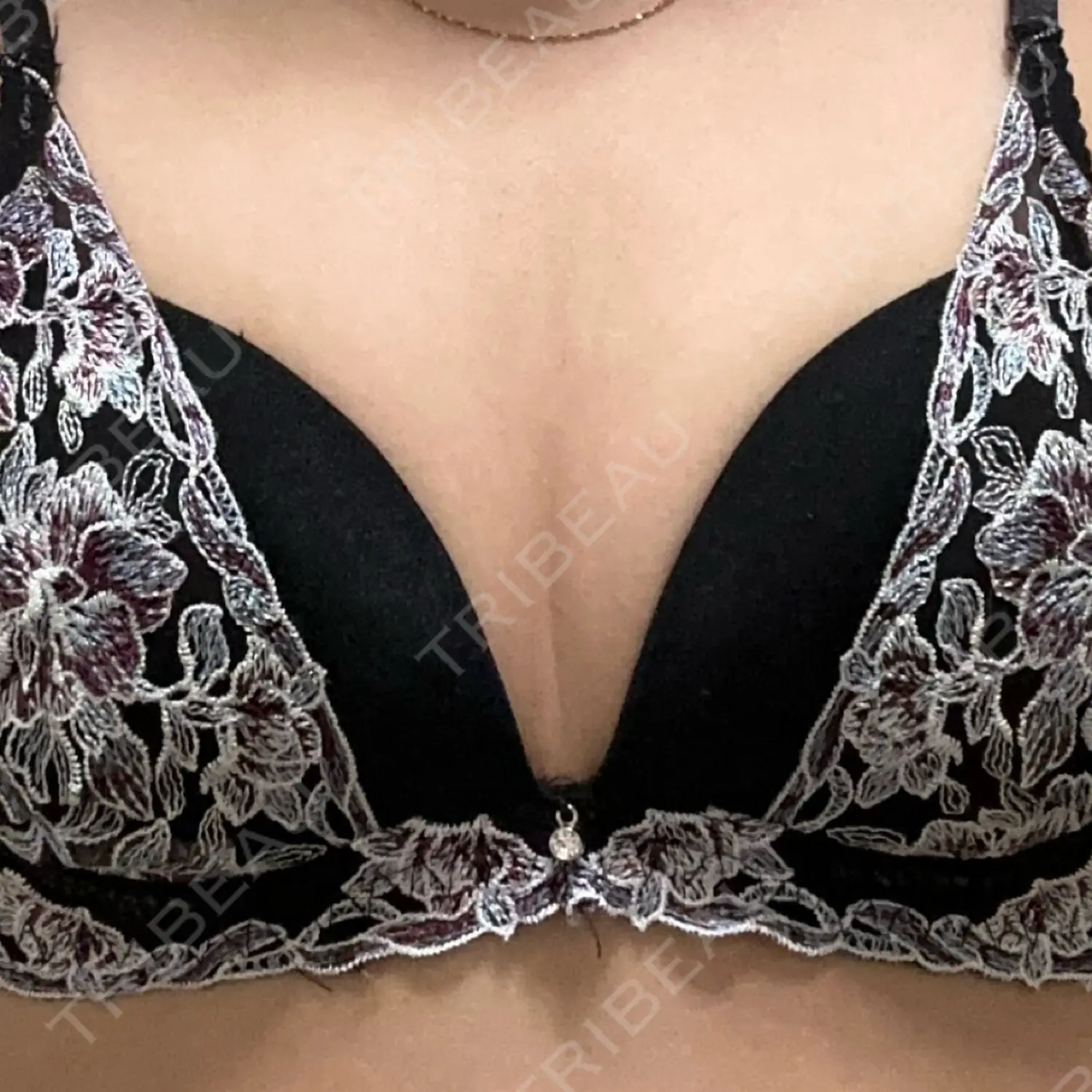 施術前の写真