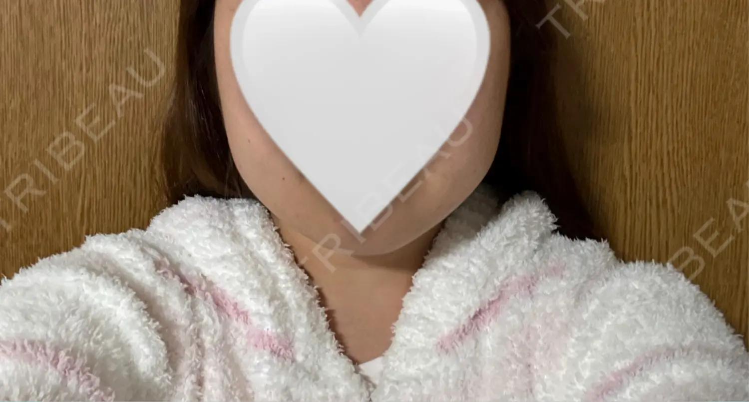 施術前の写真