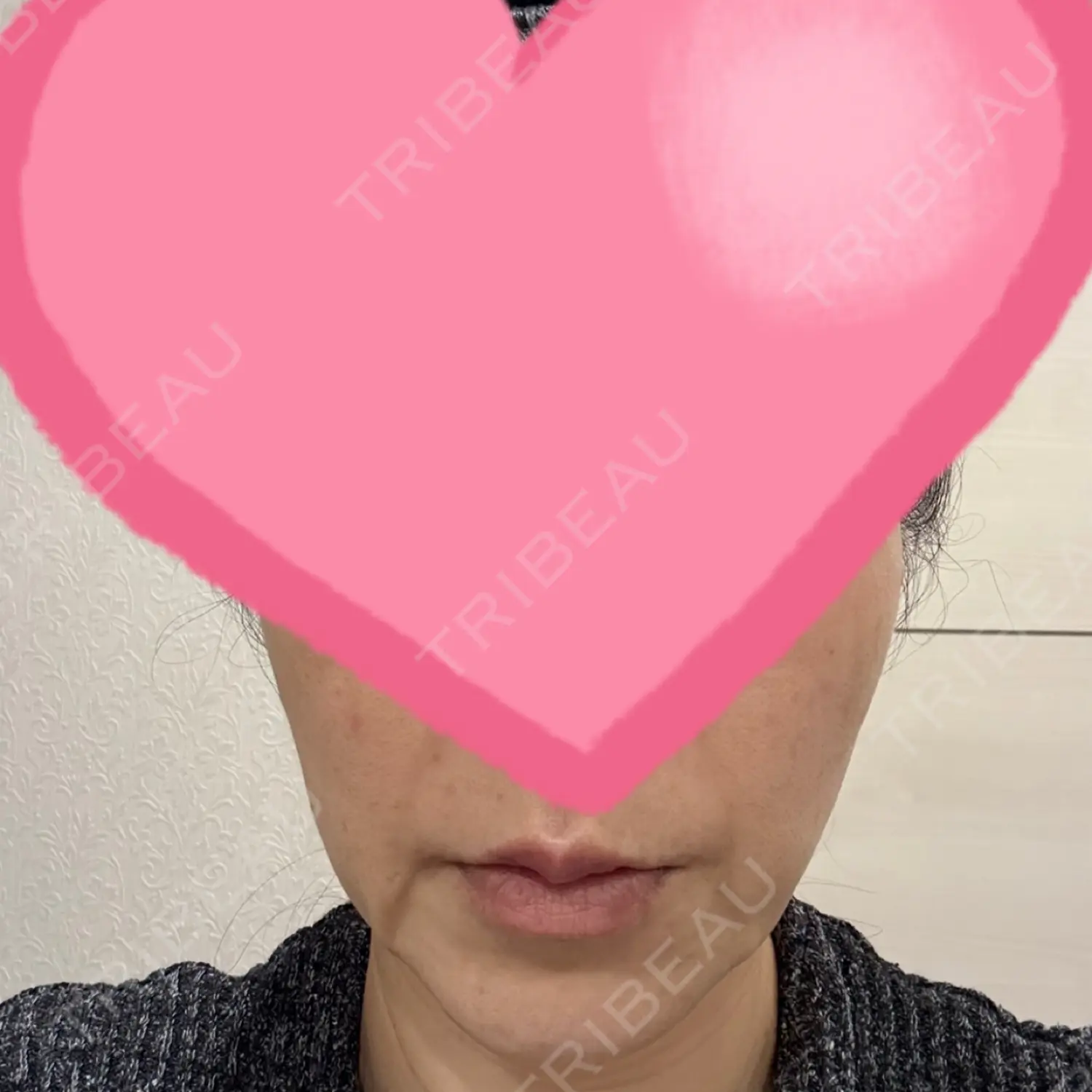 施術前の写真