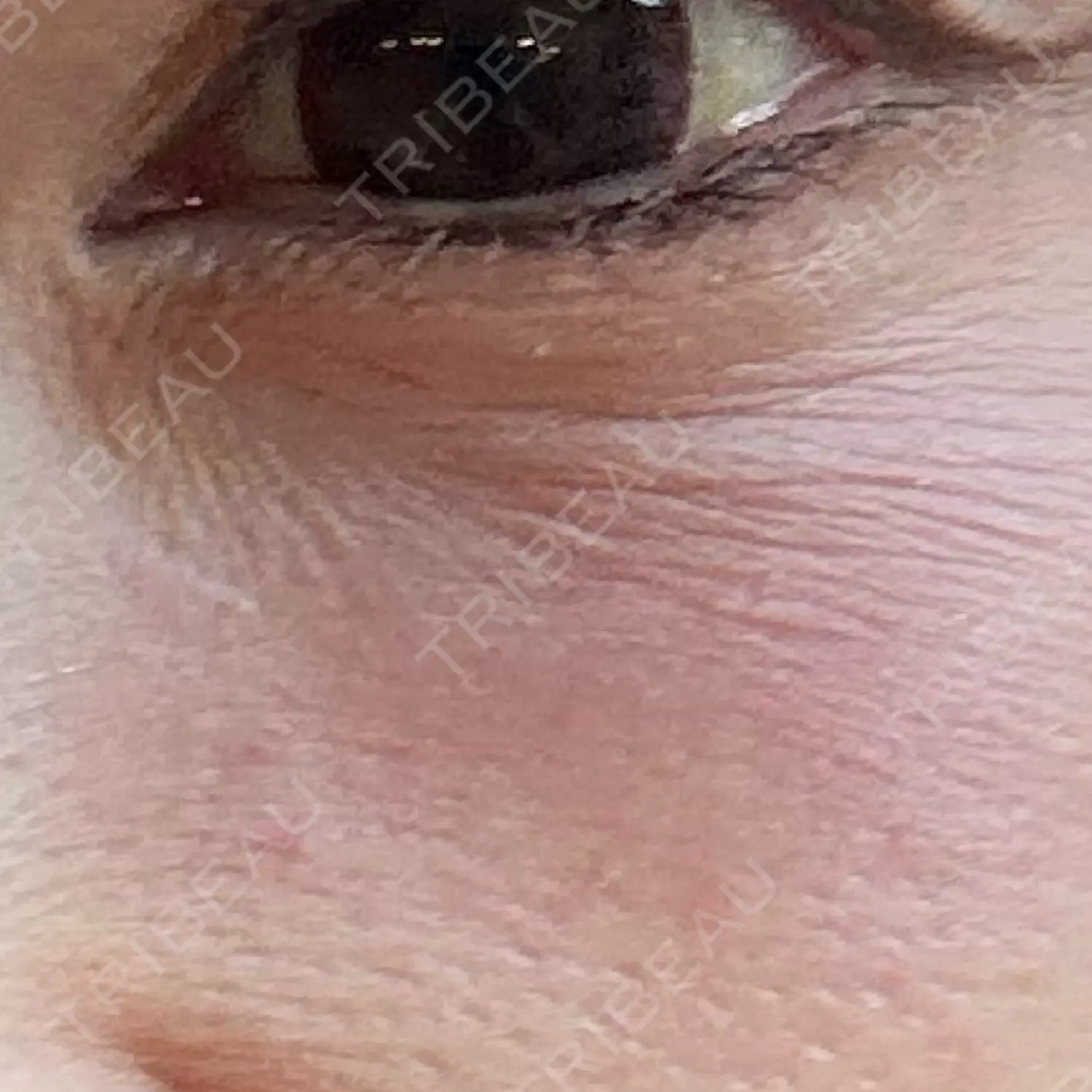 施術前の写真