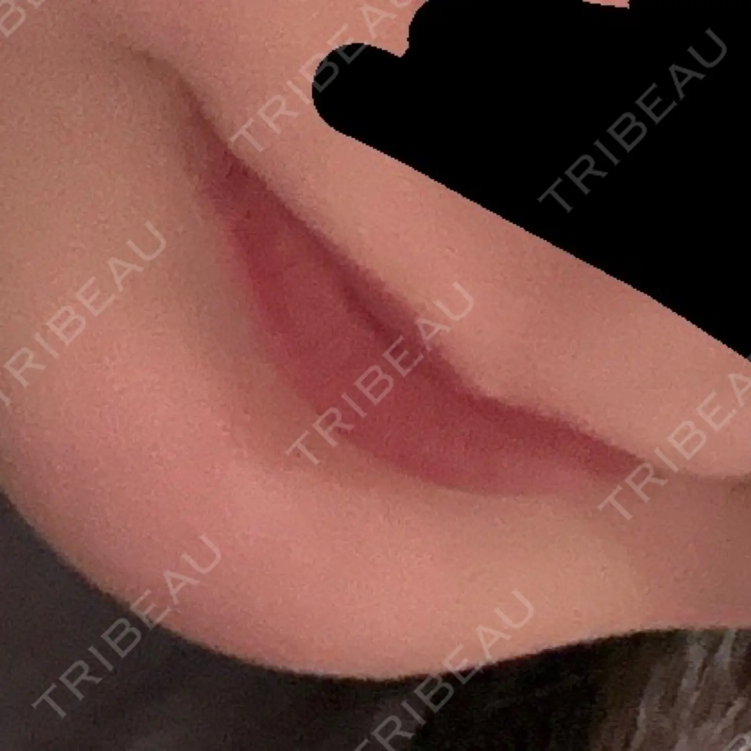 施術前の写真
