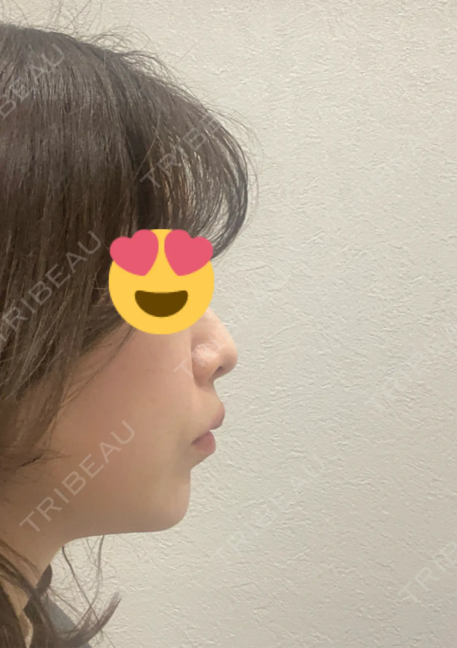 施術前の写真