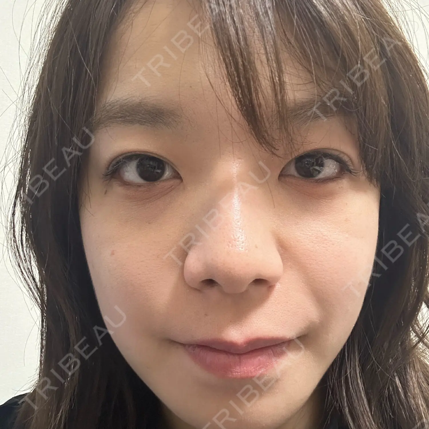 施術前の写真