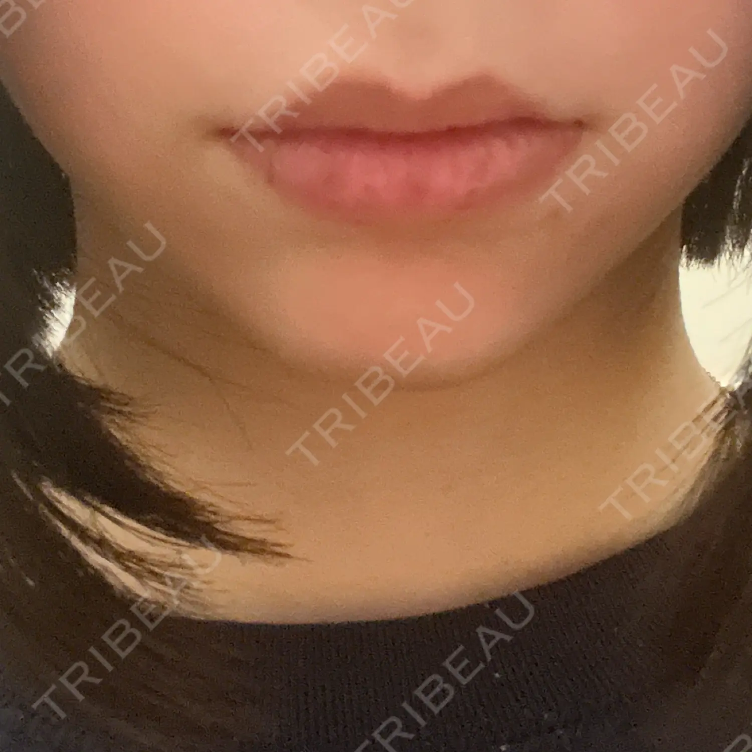 施術前の写真