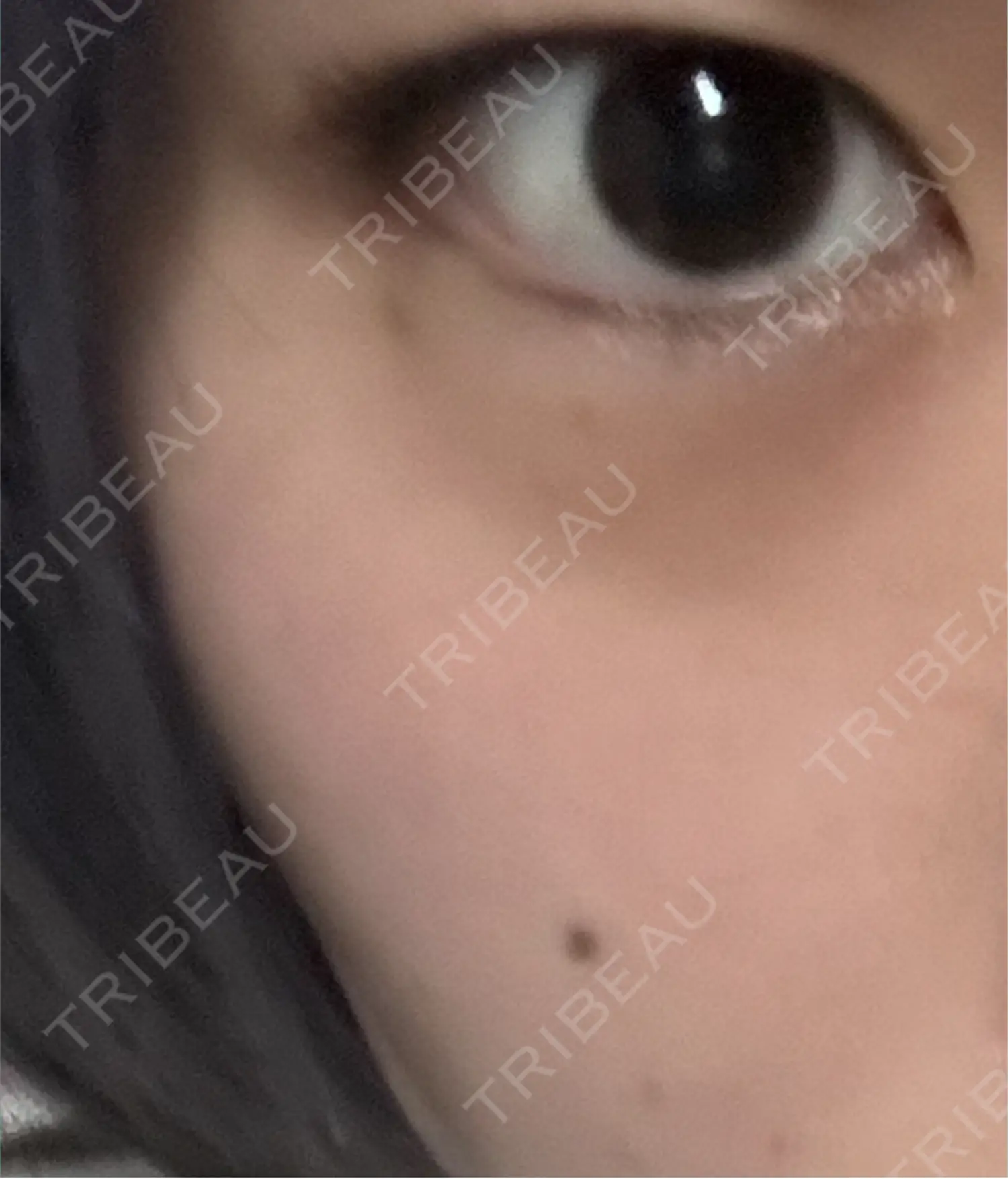 施術前の写真