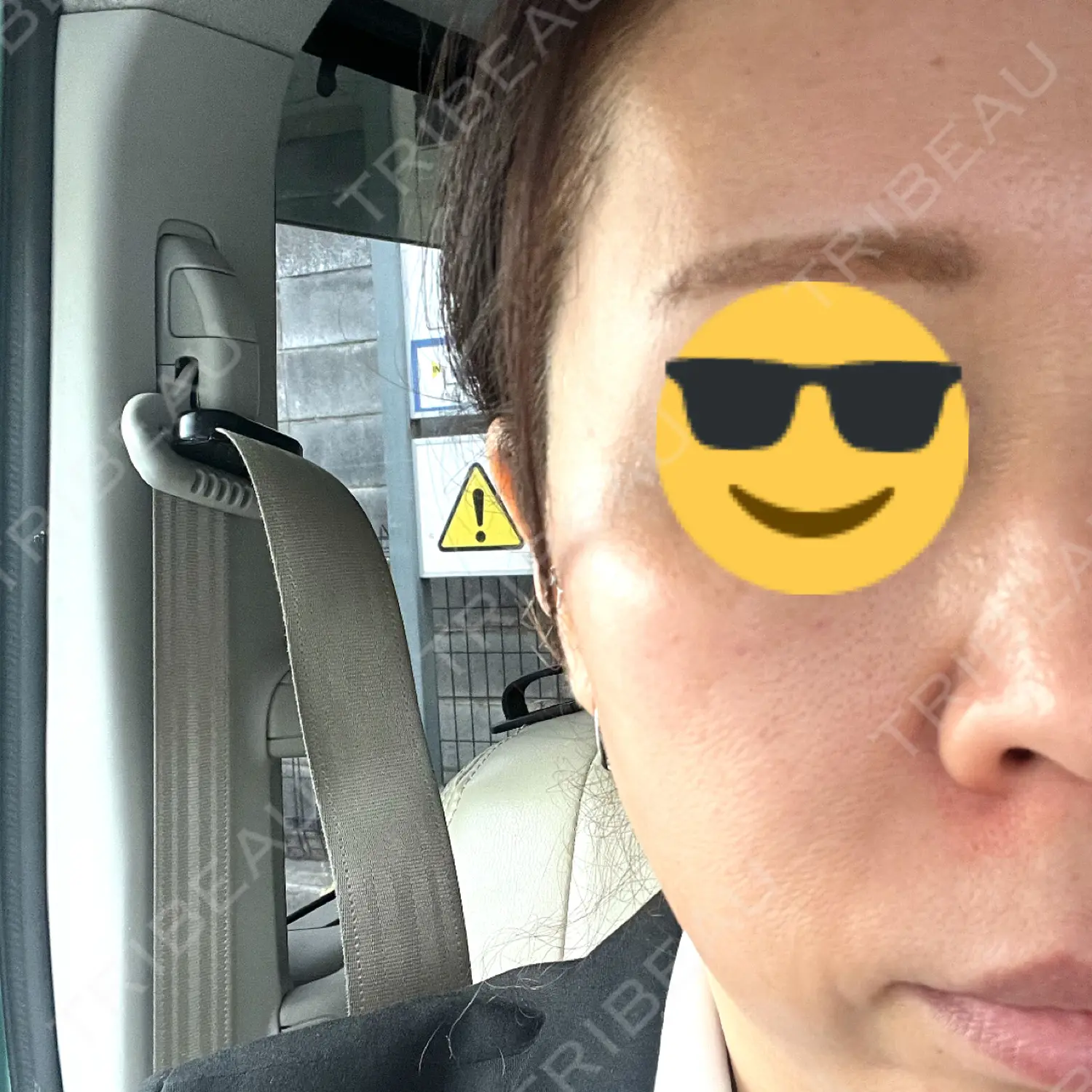 施術前の写真