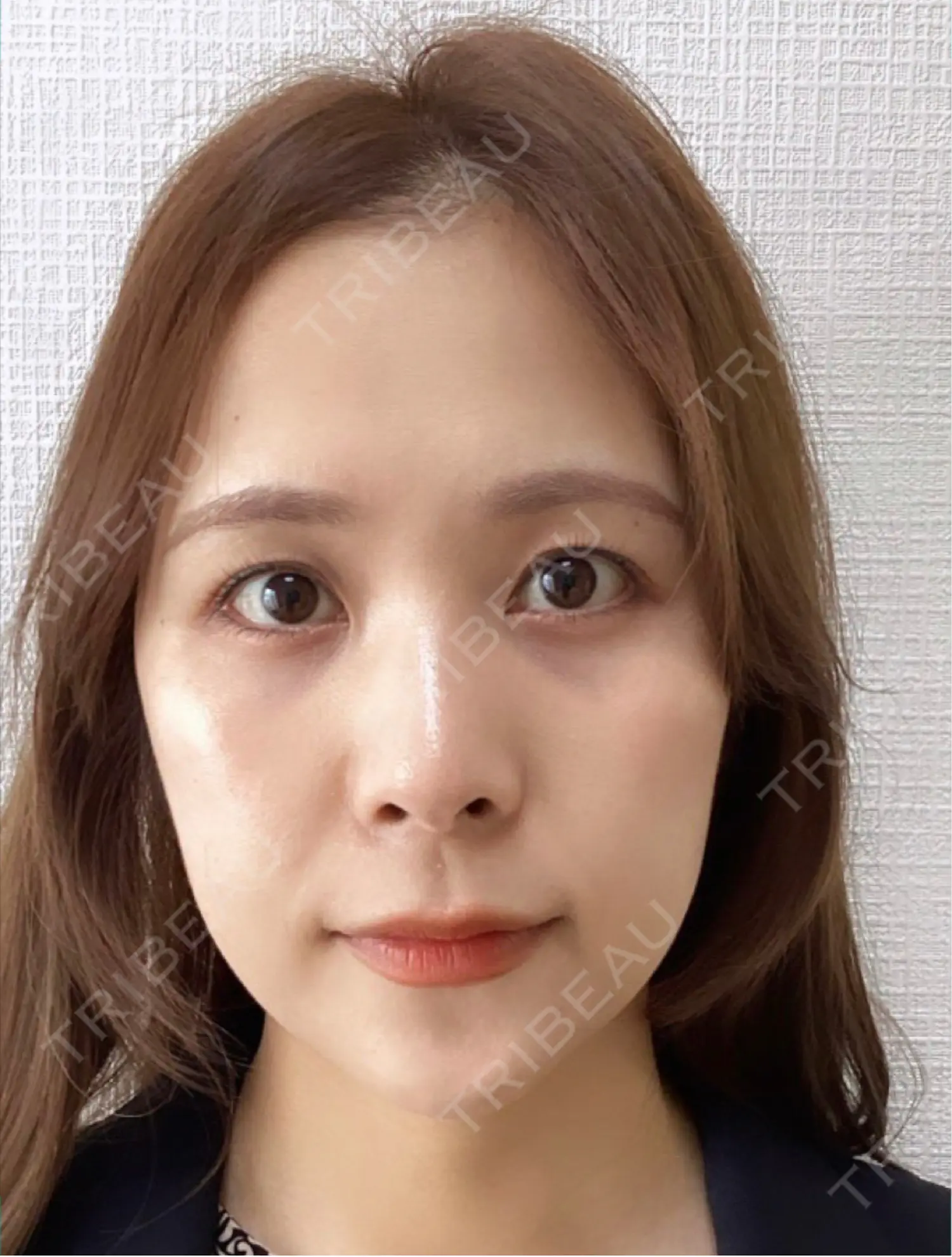 施術前の写真