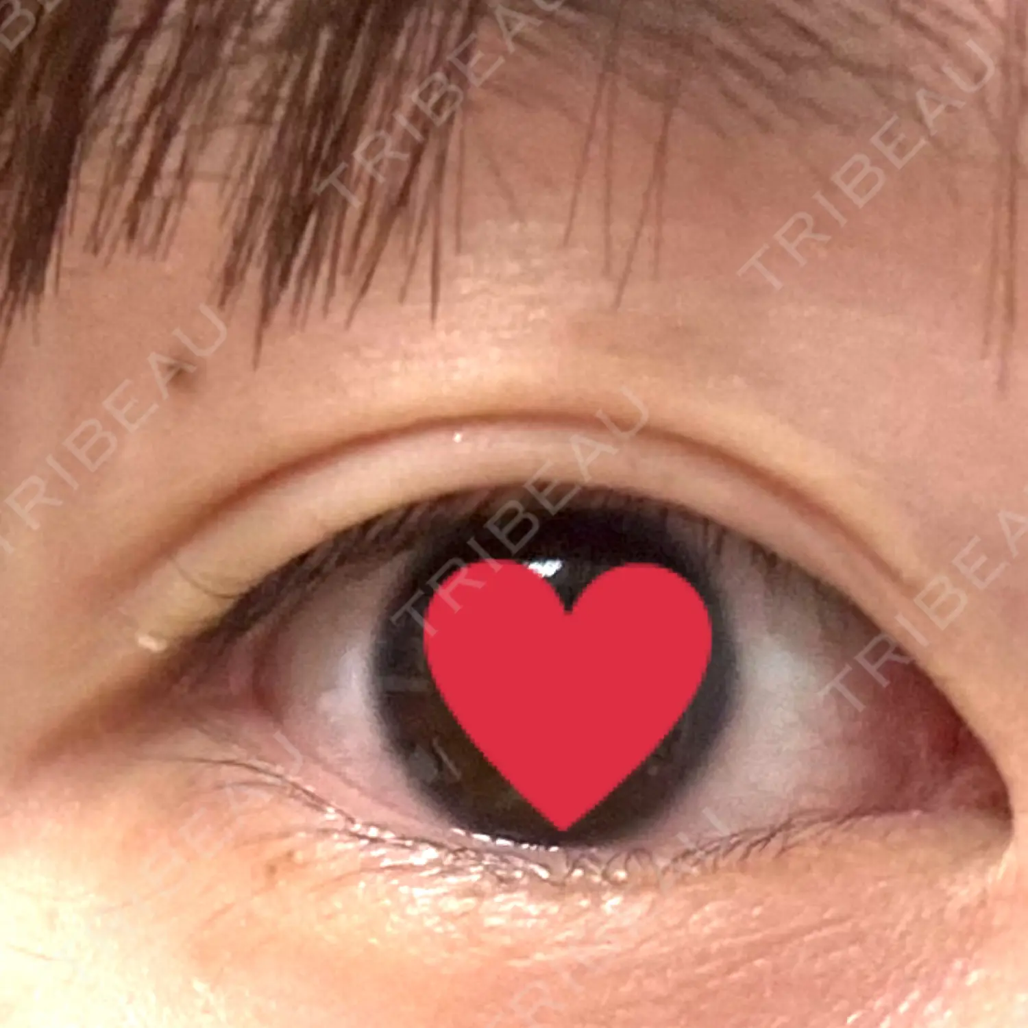 施術前の写真