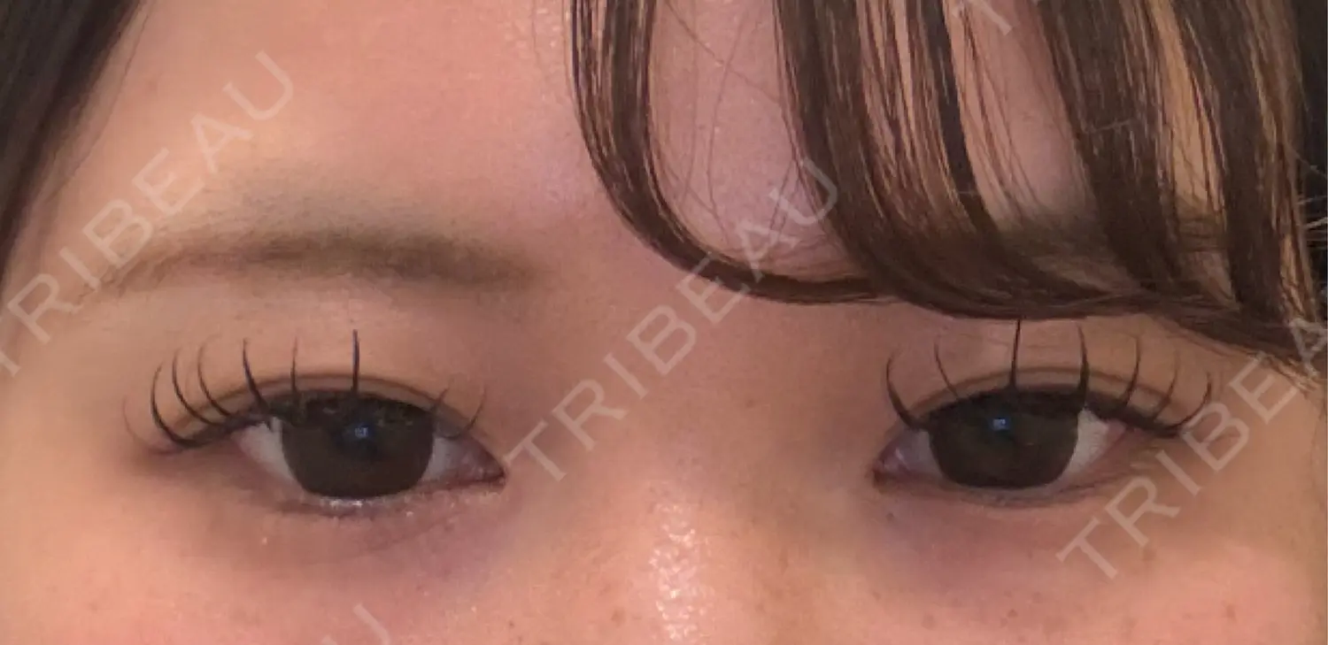 施術前の写真
