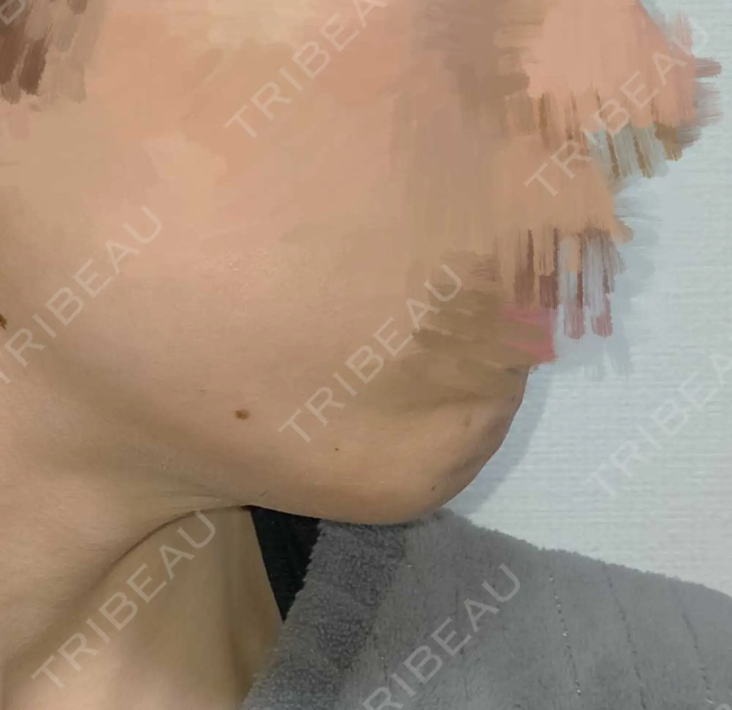 施術前の写真