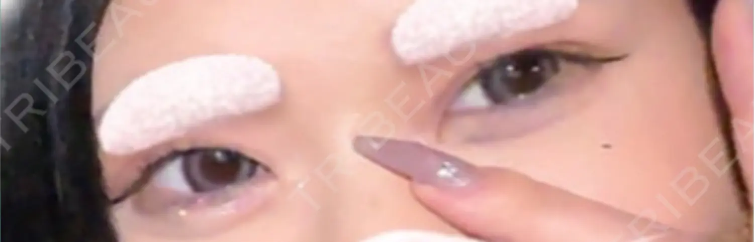施術前の写真